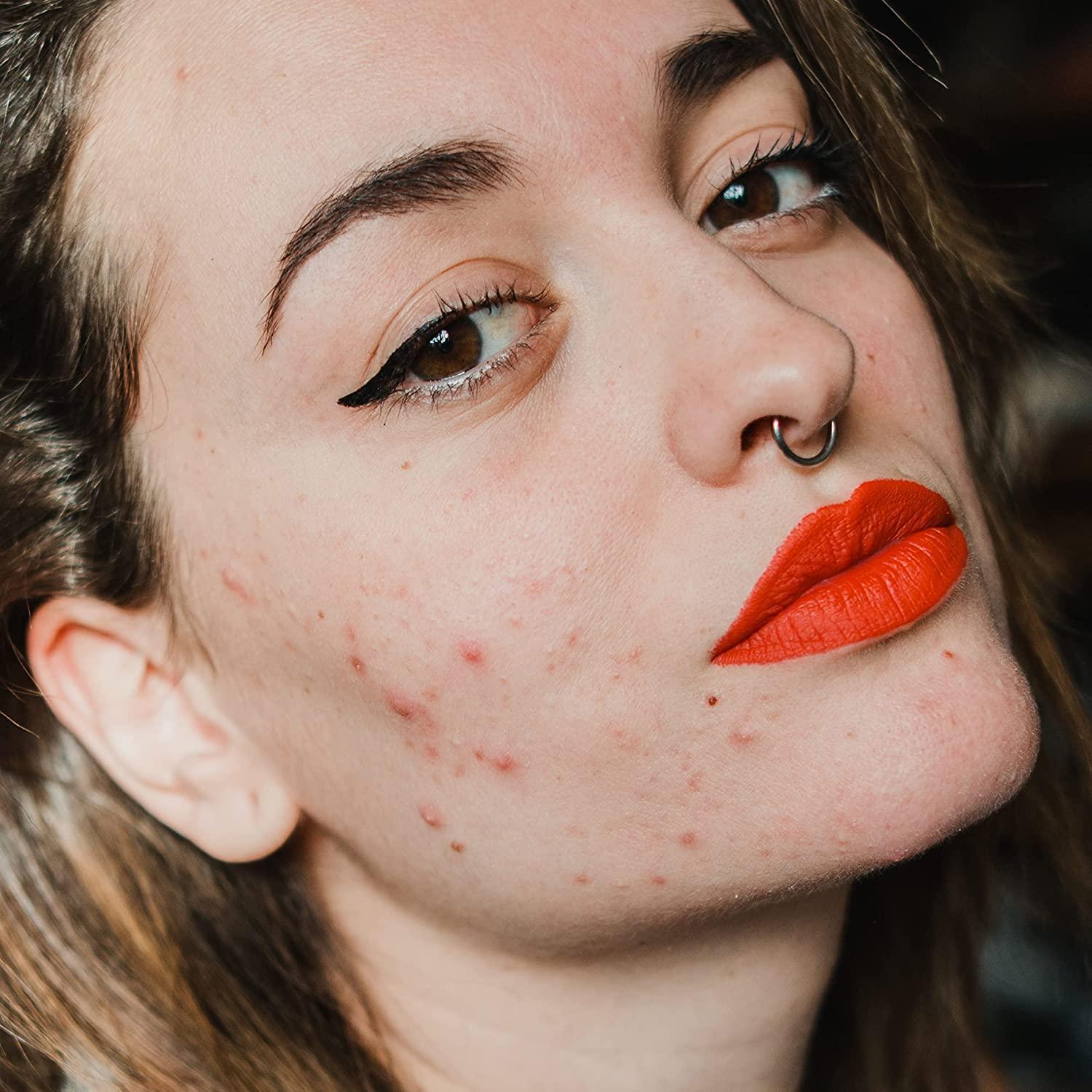 Neutrogena Blackheads Daily Acne Facial Serum Salicylic Glycolic Acids OilFree Serum for