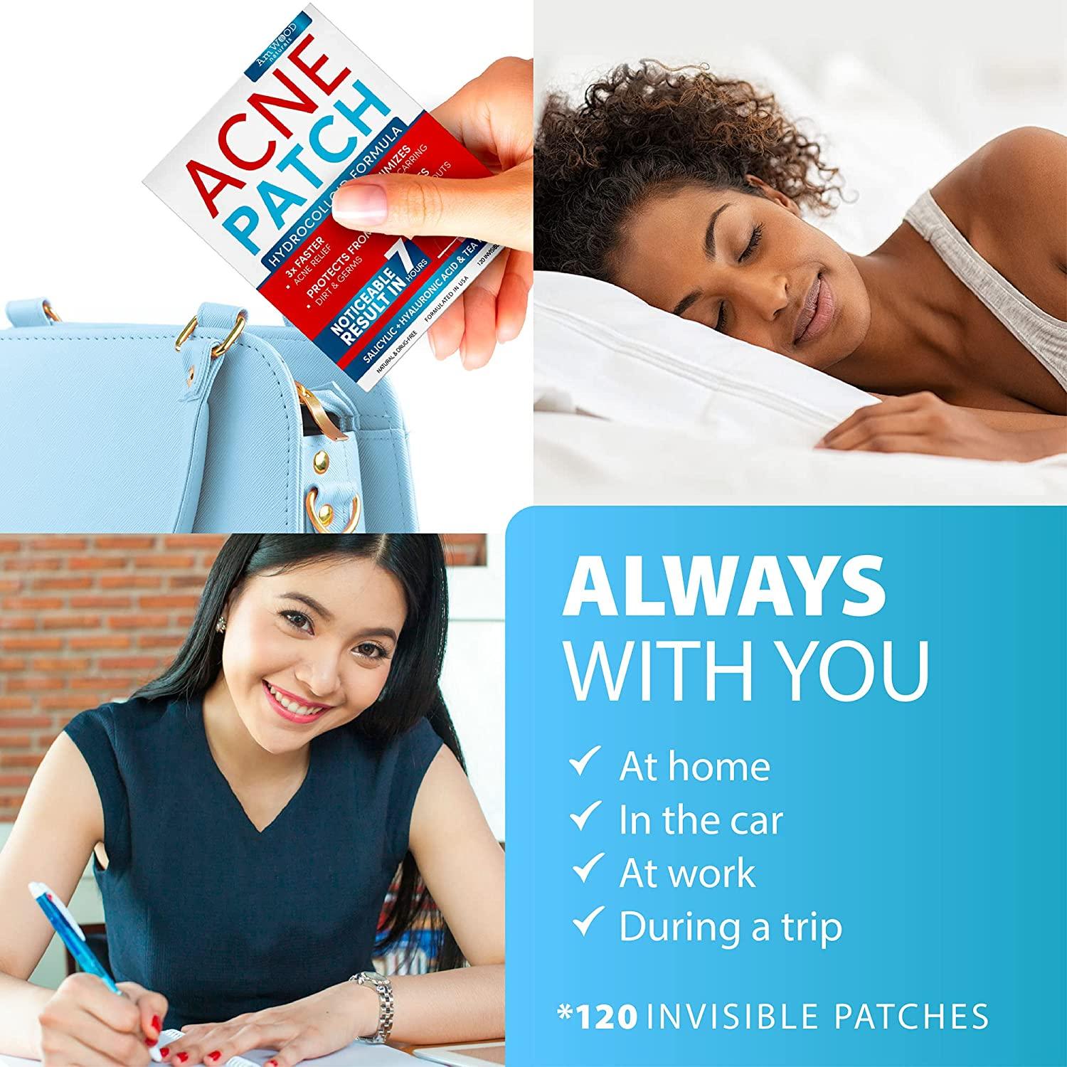 Acne Patches Hydrocolloid Bandages with Salicylic & Hyaluronic Acids