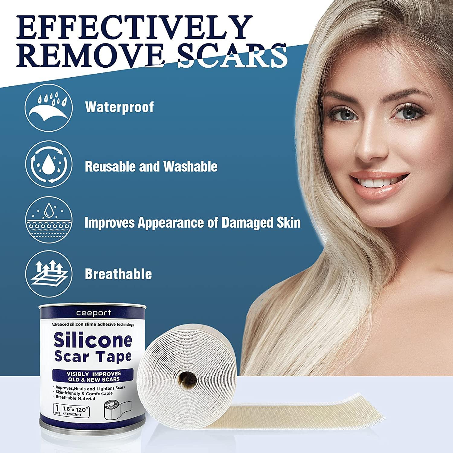 Silicone Scar Tape for Scar Away(1.6"x120"),Highly Comfortable and