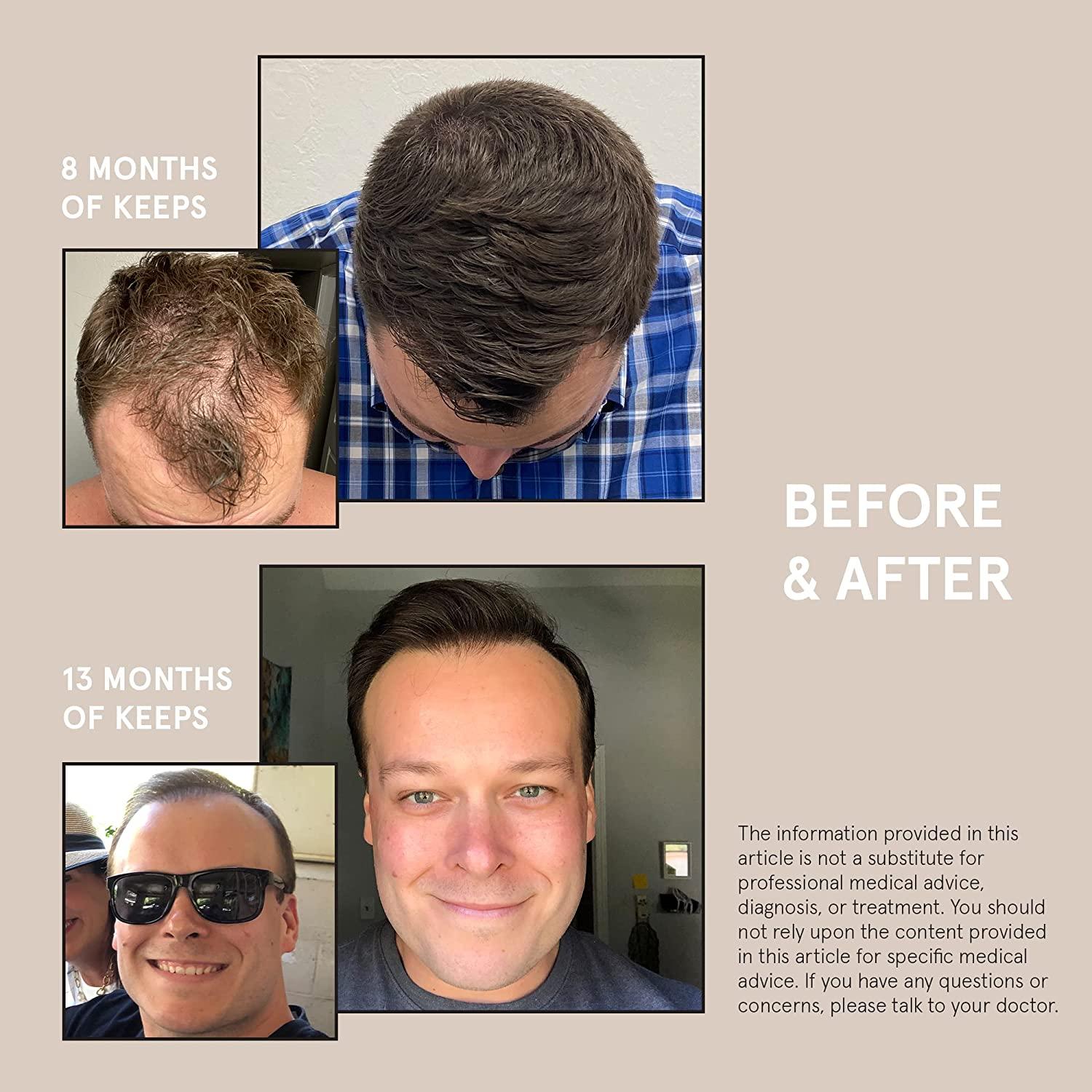 Thickening Hair Loss Treatment Set Biotin, Caffeine & Saw Palmetto Infused Shampoo