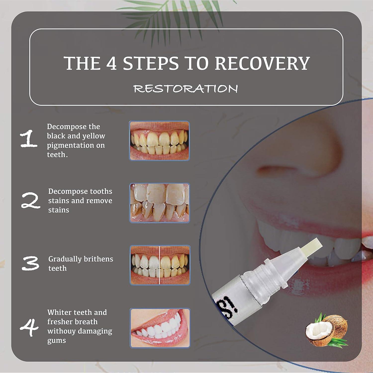 Teeth Whitening Pen (x3) by iSmile Mint Flavoured Teeth Whitening