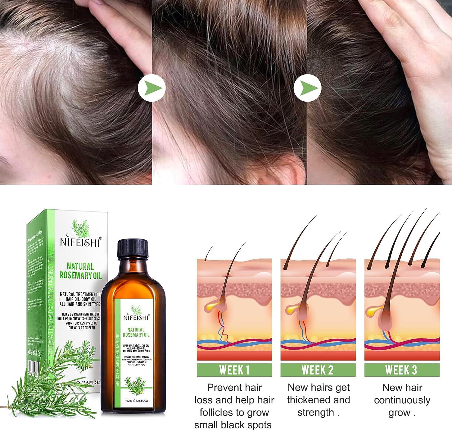 Rosemary Oil for Hair Growth & Skin Care (3.5 Oz) 100% Pure Rosemary  Essential Oil for Eyebrow and Eyelash Nourishes The Scalp for Aromatherapy  & Diffuser Hair Loss Treatment Oil for Women