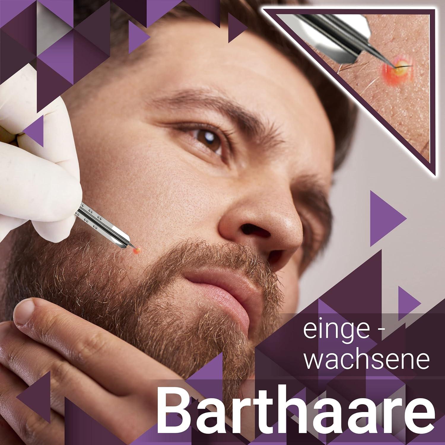 200 x Milia Lancets Lancets Sterile Pointed Kosmetex Blood Lancets