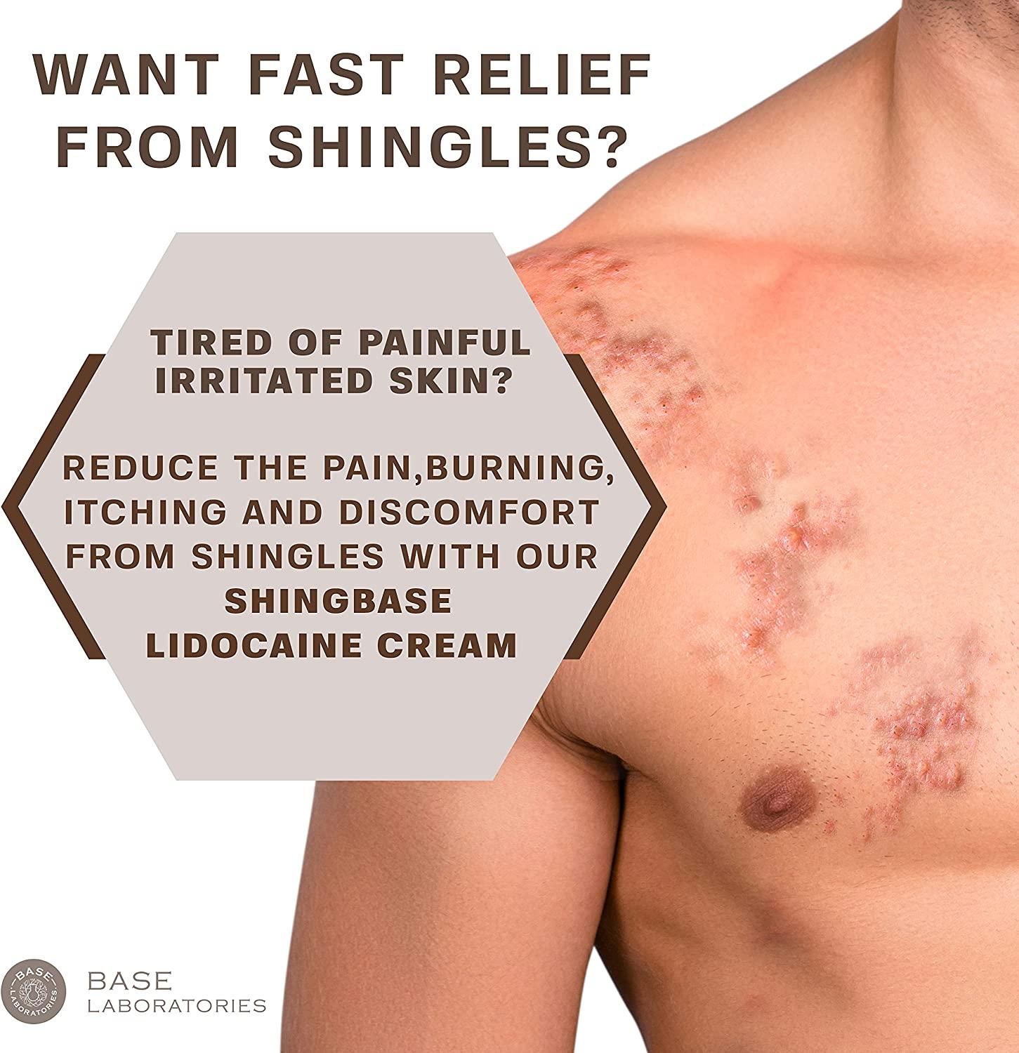 Shingbase Maximum Strength Shingles Cream with Lidocaine for Nerve Pain
