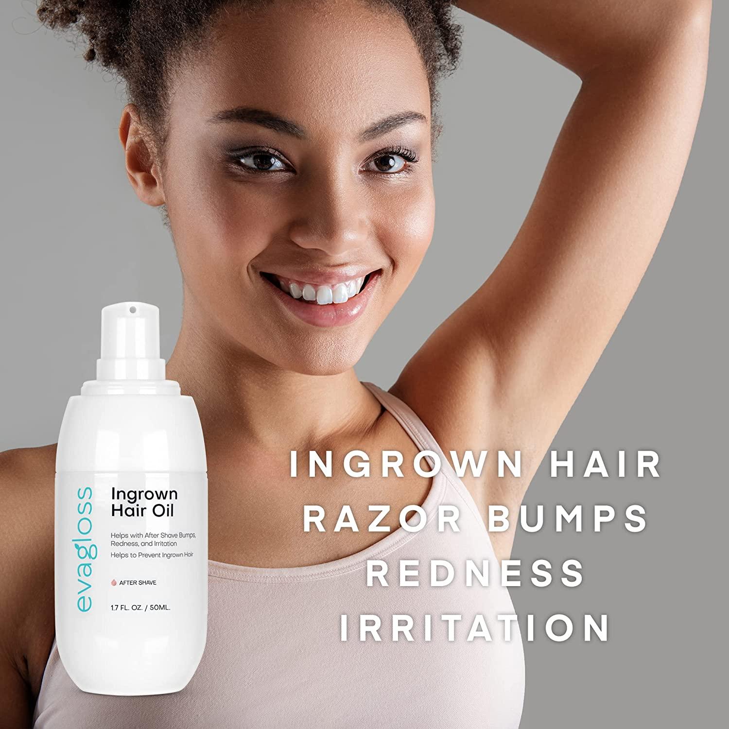 Ingrown Hair Treatment Oil Prevents Ingrown Hair Helps with Razor Bumps