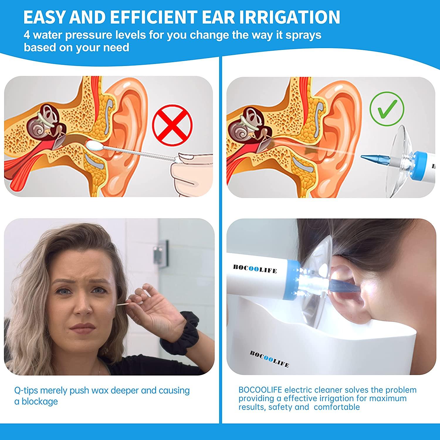 Electric Ear Wax Removal Tool Ear Cleaning Kit Safe and Effective Ear  Irrigation Flushing System Reusable Ear Washer for Adults with Ear Cleaner