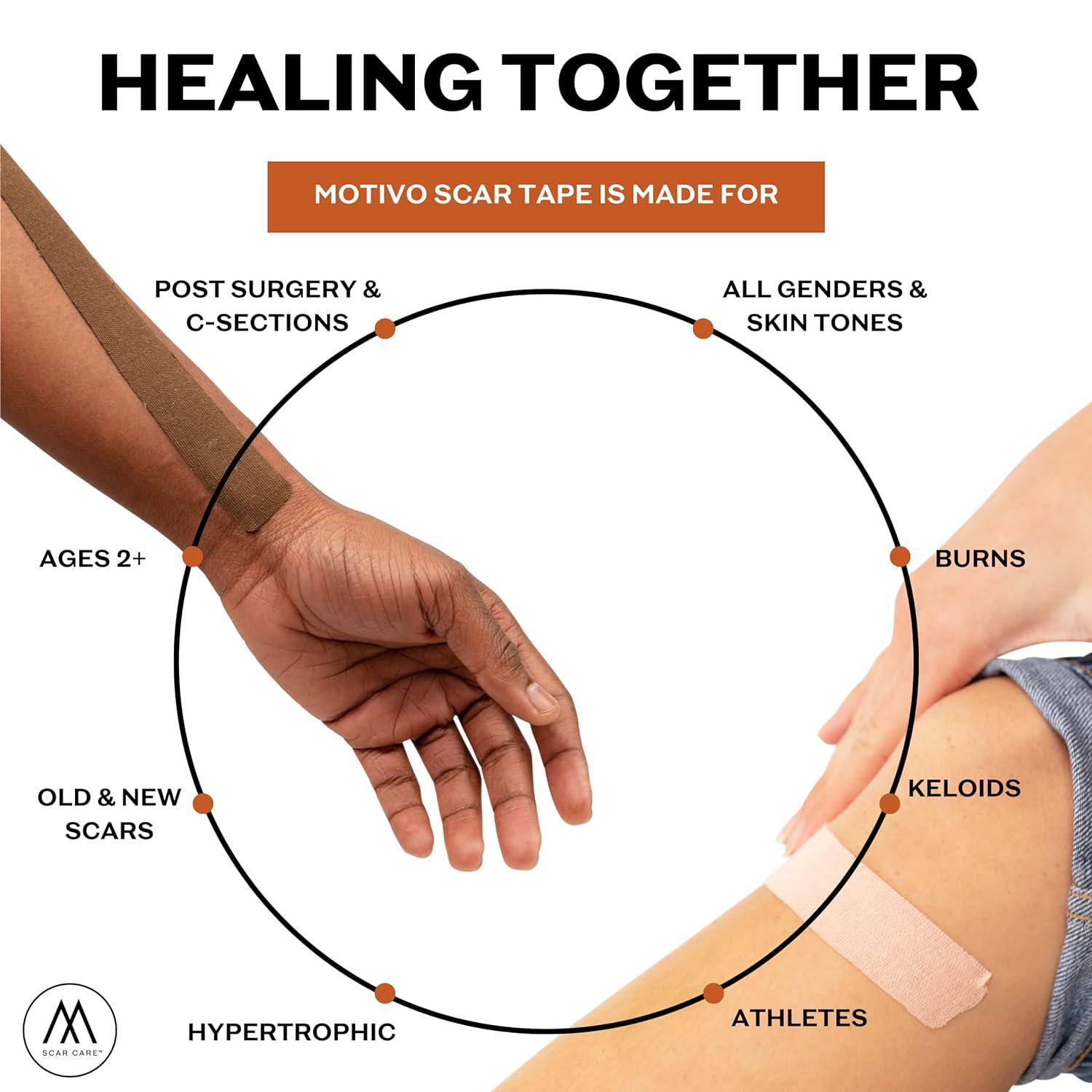 Motivo Advanced Scar Care Bundle Scar Tape & Scar Cream (15ml) Water