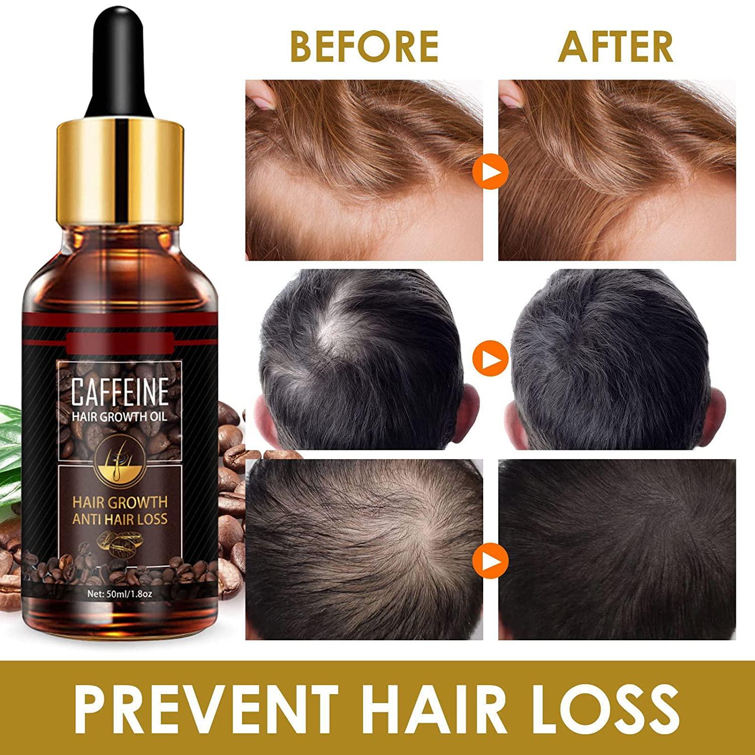 Hair Growth Serum, Hair Oil for Dry Damaged Hair and Growth, Hair