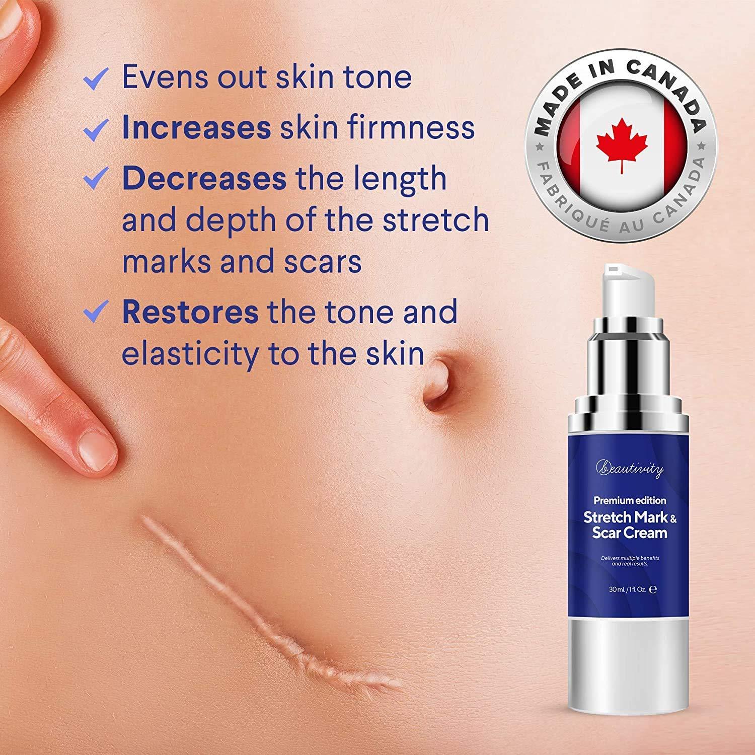 Premium Scar Remover Cream Effective for CSection, Stretch Marks, Acne & More Made in Canada