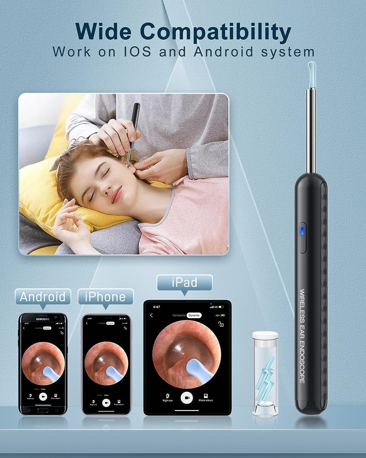1080P Ear Wax Removal Camera Kit for iPhone, iPad & Android Includes