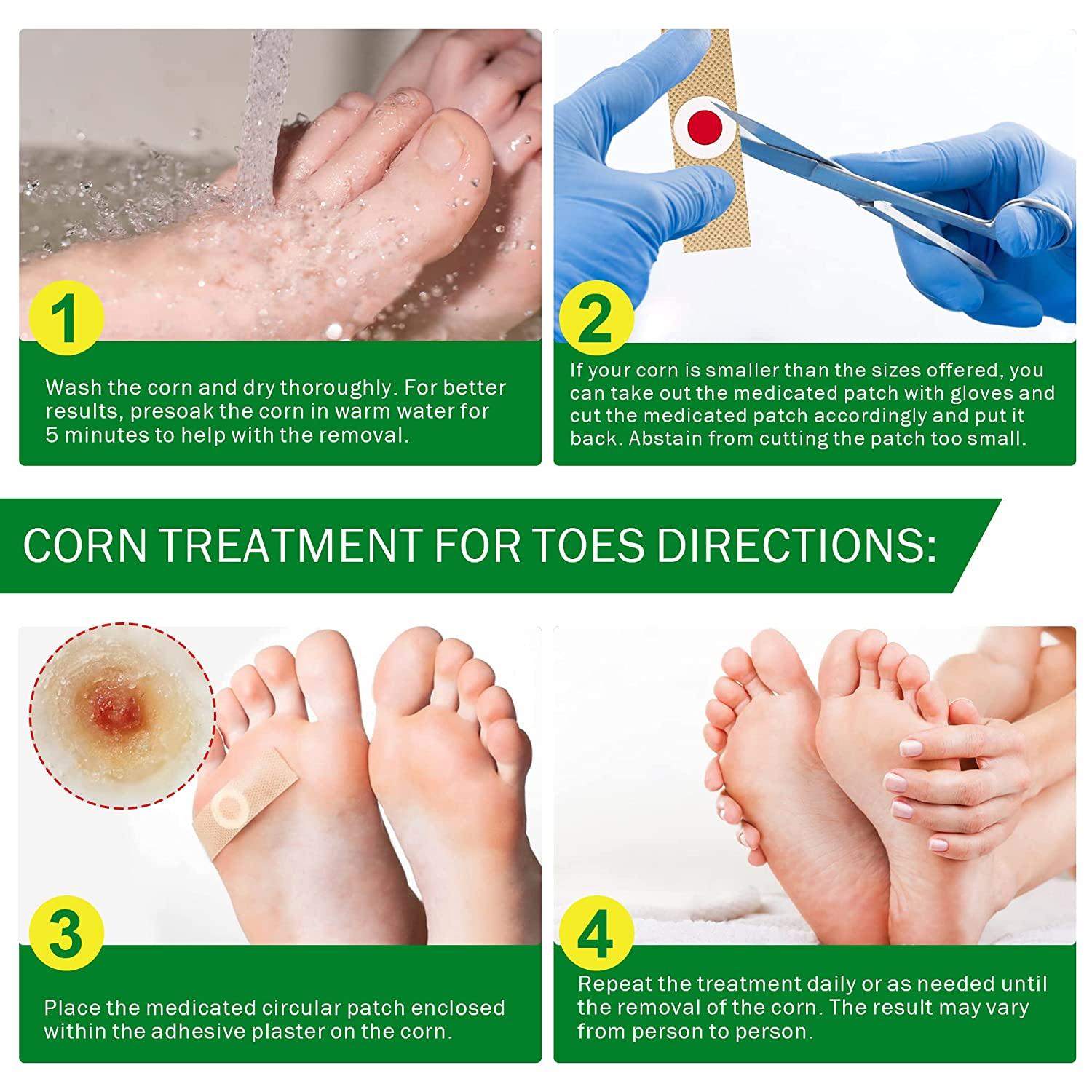Corn Removers for Feet & Toes, Corn Removers with Salicylic Acid, Corn  Removers for Toes Pads, Foot Corn Remover & Callous Remover, Corn Pads for  Toes & Feet, 24 Pack Red