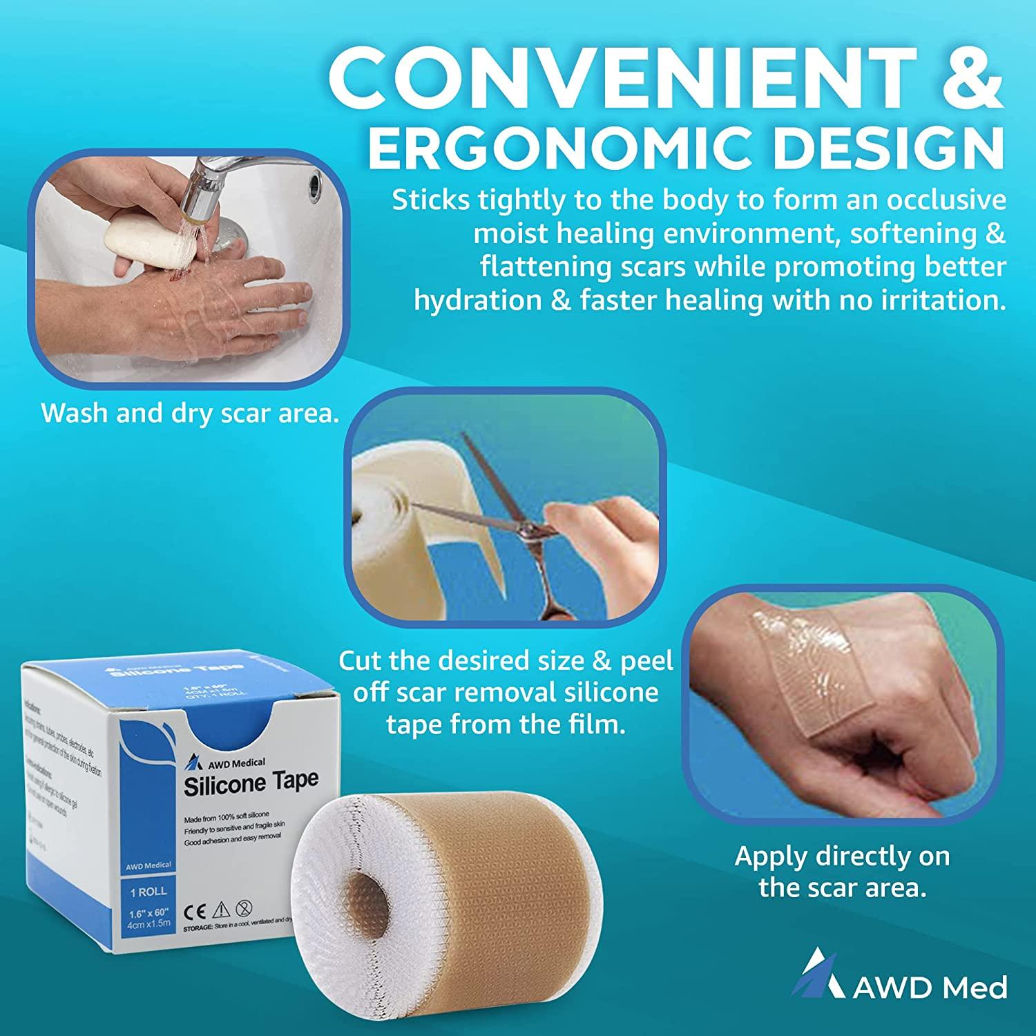 AWD Medical Silicone Scar Sheets Soft Silicone Scar Tape for Scar