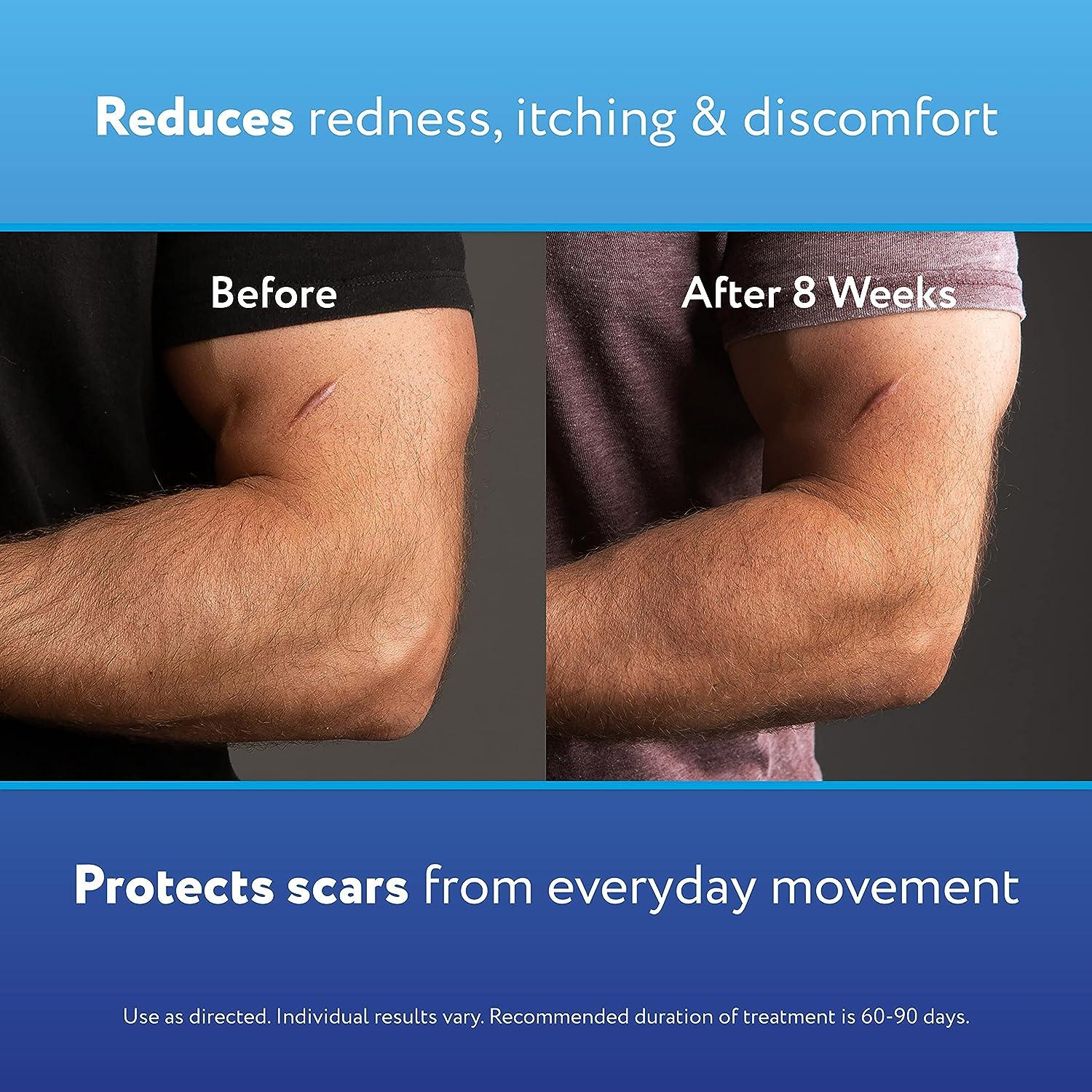 ScarAway Advanced Skincare Silicone Scar Sheets Medical Grade Silicone