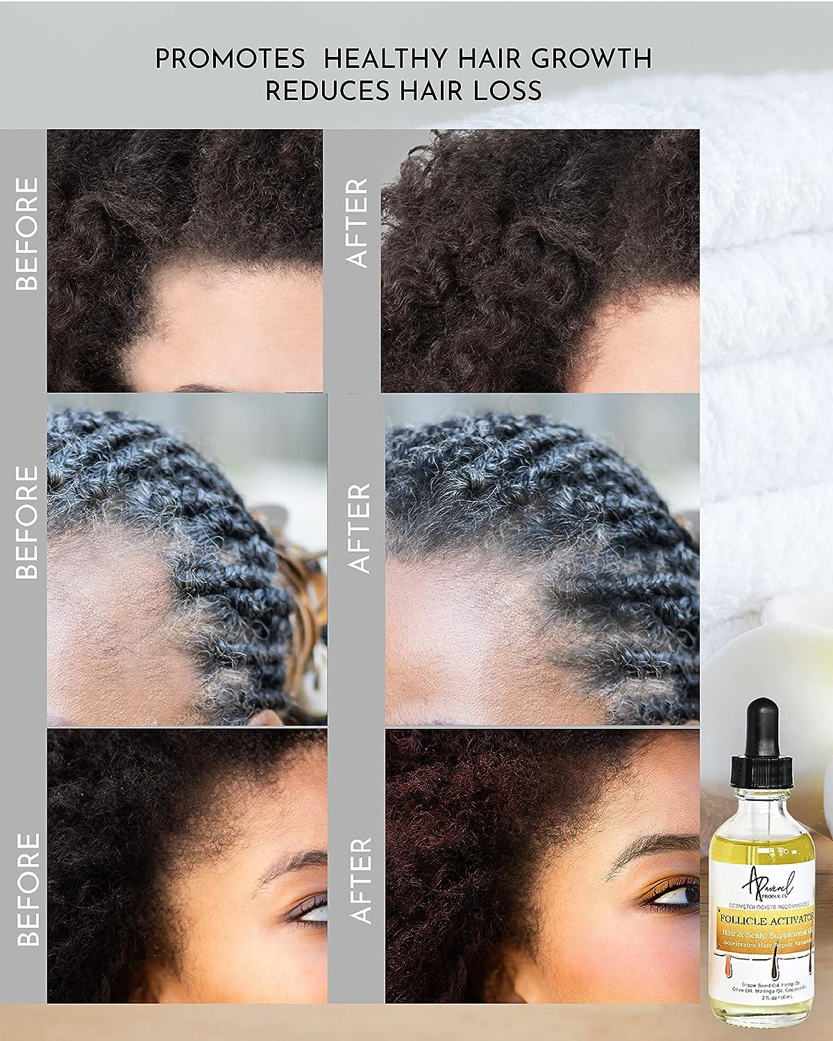 Aravenel Products Hair Follicle Stimulator 2Fl Oz Hair Growth Oil for