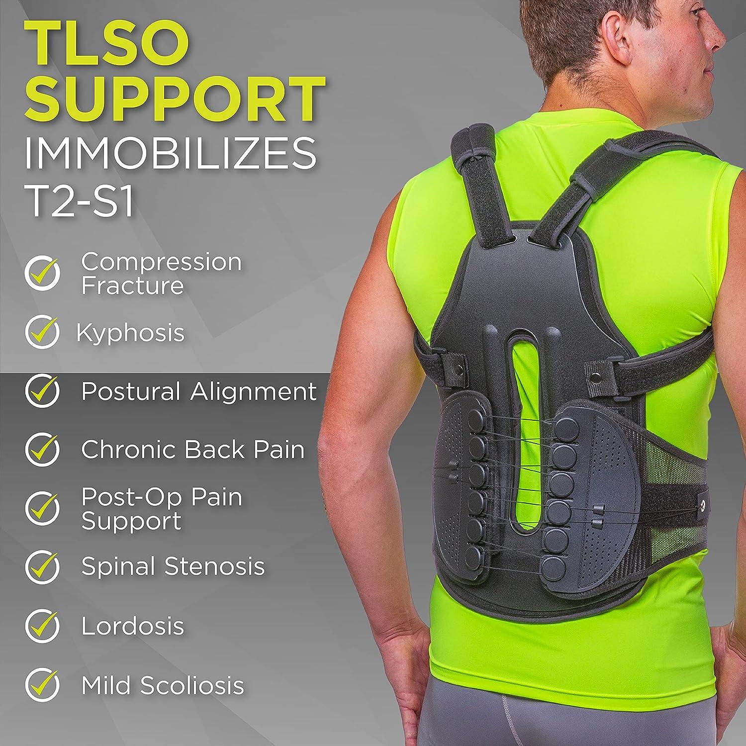 PDF] Early mobilization with customized TLSO brace in