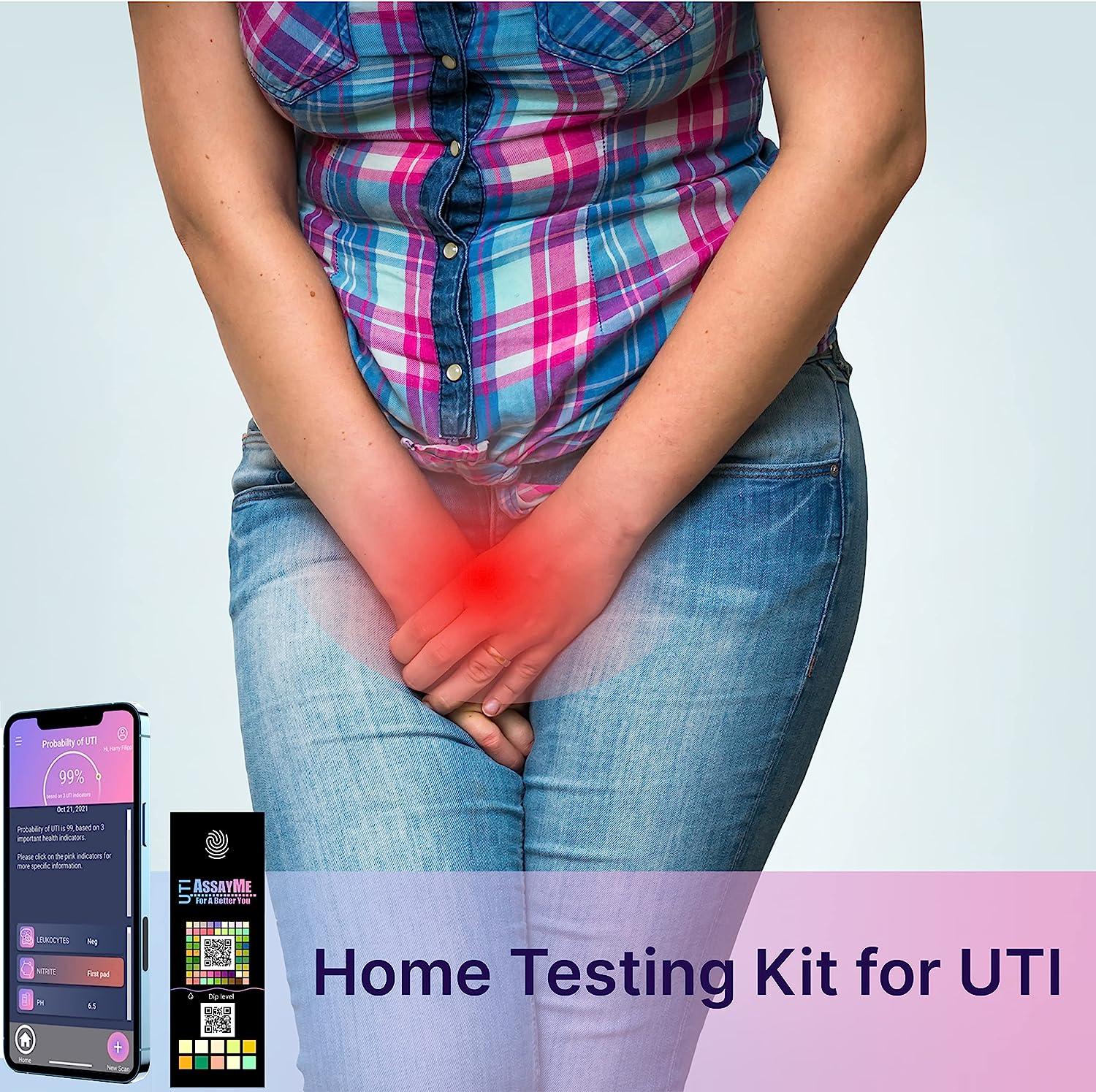 AssayMe UTI Urine Test Strips Urinalysis Test for Infection 3 Strips