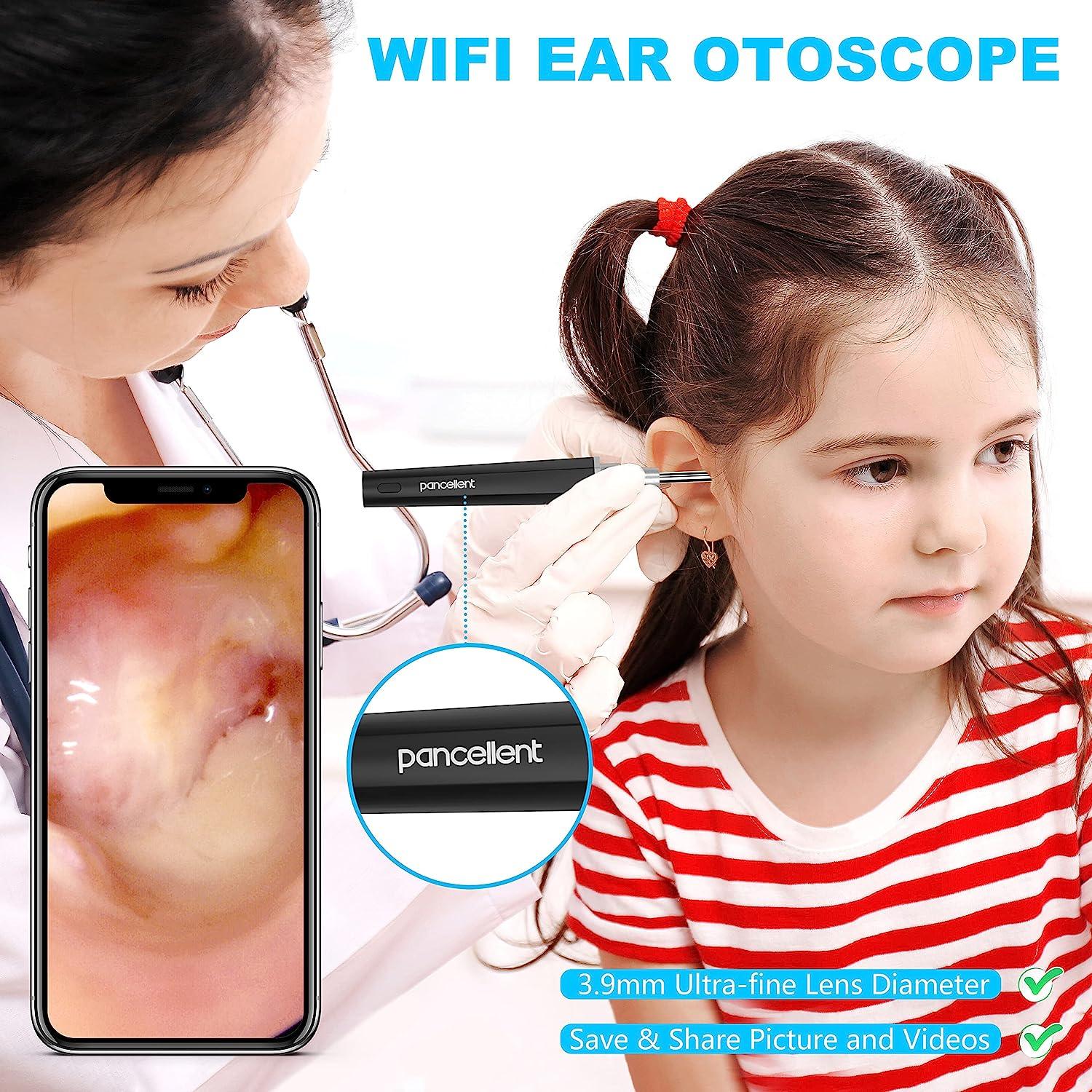 ear endoscope camera price