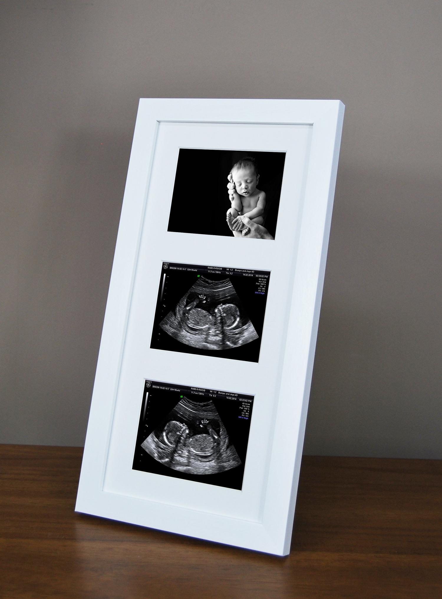SignatureFrames Baby Scan Photo Frame. Triple ultrasound scan frame in