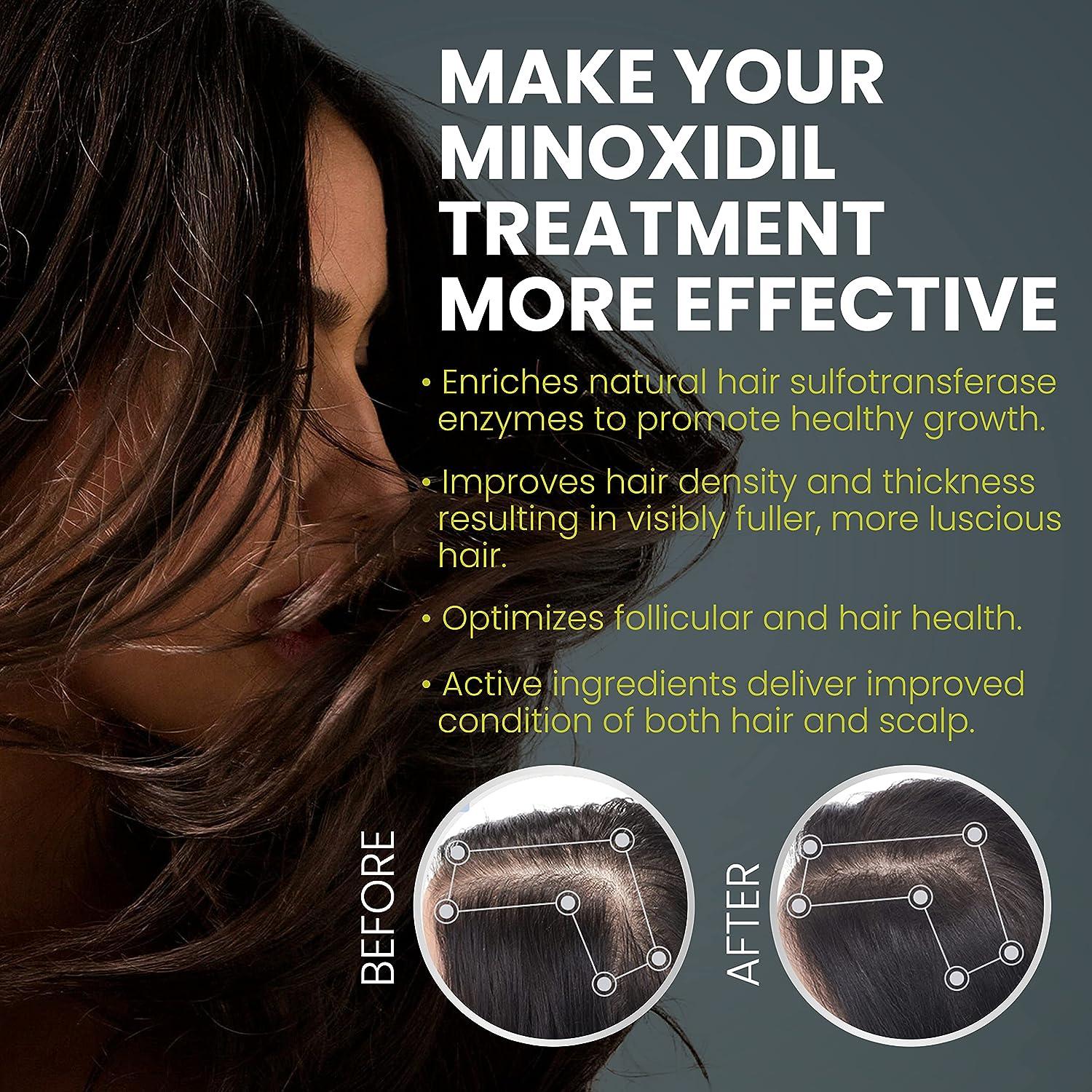 Minoxidil Booster Spray for Hair Loss - Enhances Absorption 7X for  Non-Responders with Low SULT1A1 Enzyme Levels