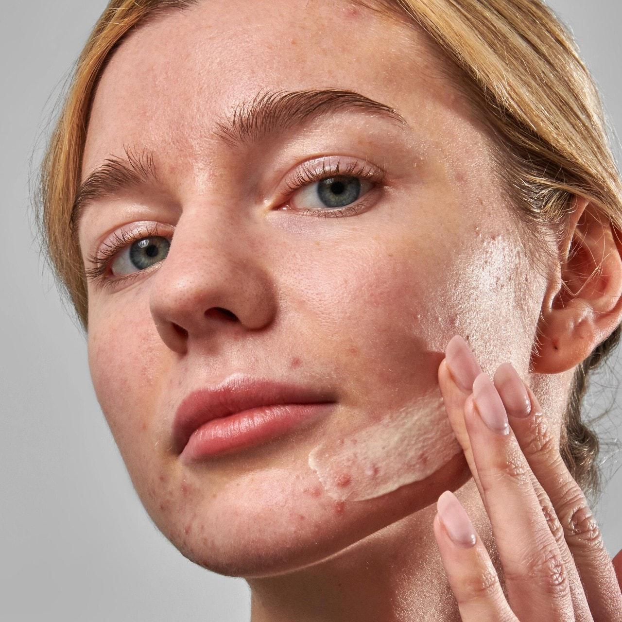 Shop The INKEY List SuperSolutions Acne Clearing Moisturizer 2% ...