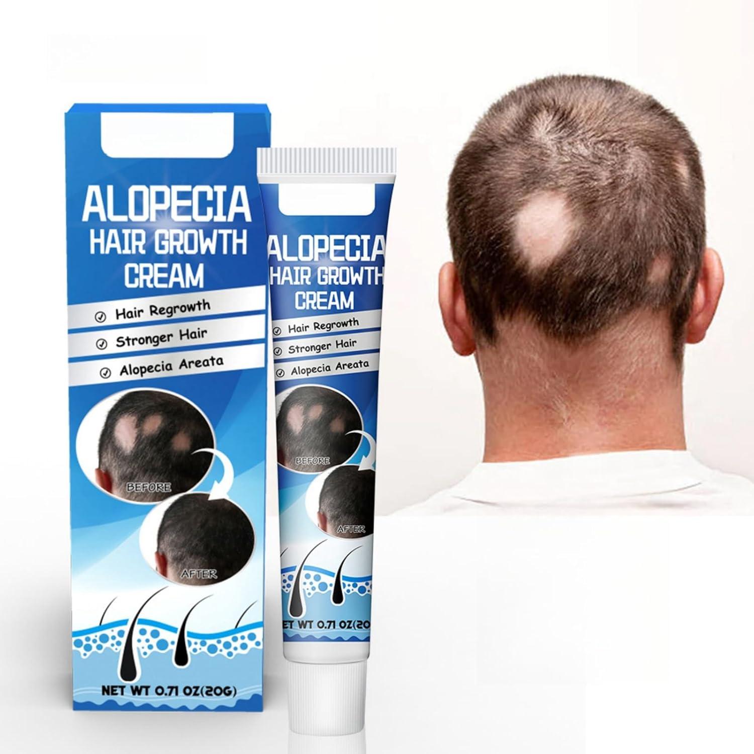 Style Alopecia GR+ サプリメント 30g 71qhb5nnpnl._ac_sl1500_.jpg