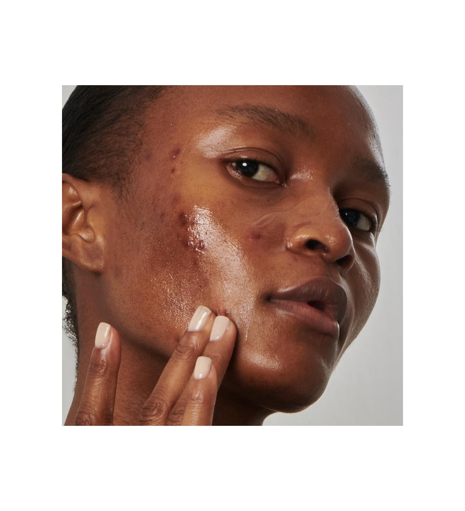 THE INKEY LIST Balancing-Pore Tightening Face Serum for Oily Skin 30 ml Ko ak446 - Buy Online on GoSupps.com