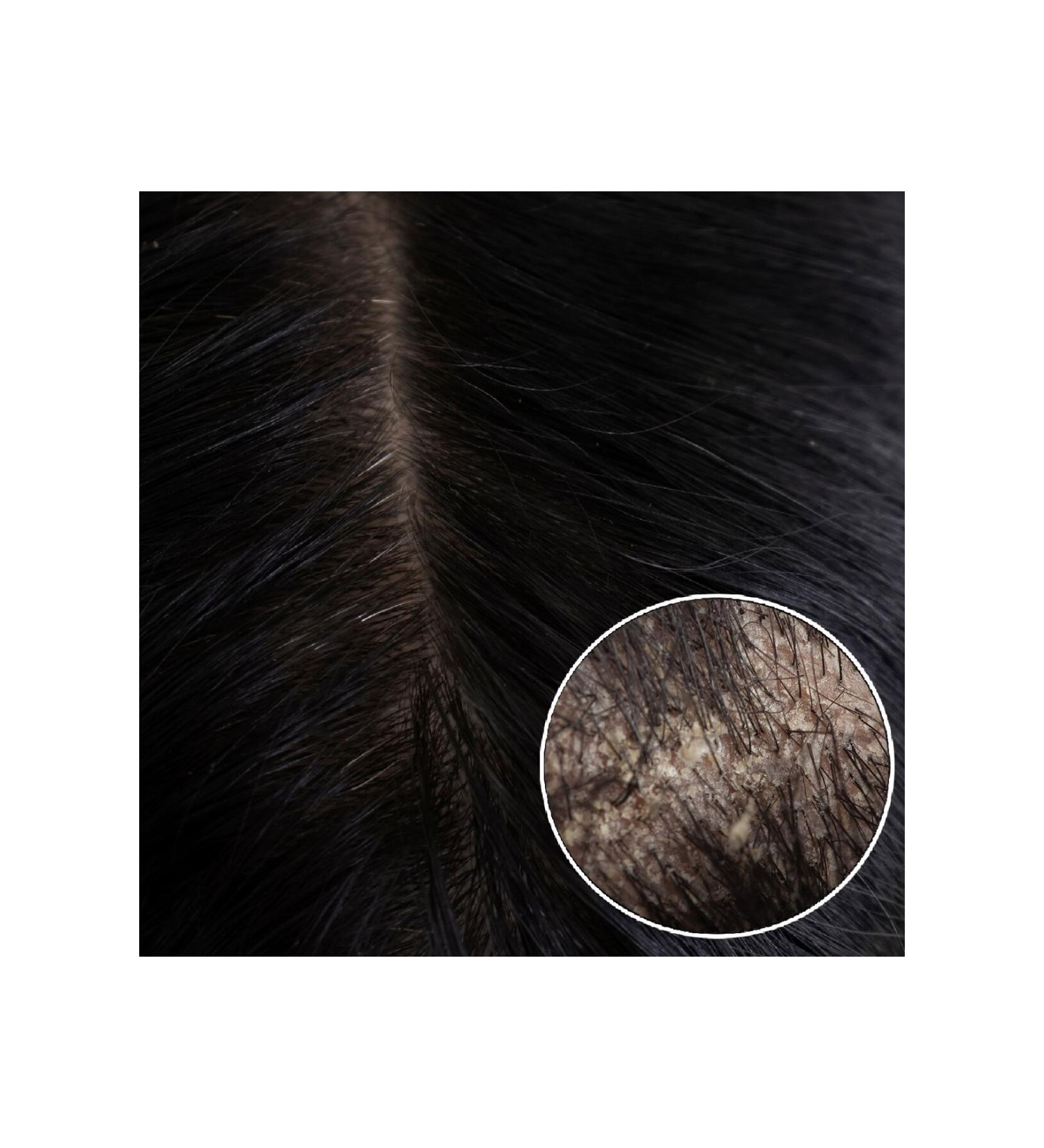 Duru Garlic & Biotin & Collagen Anti-Hair Loss Shampoo 3x700 ml - Buy Online on GoSupps.com