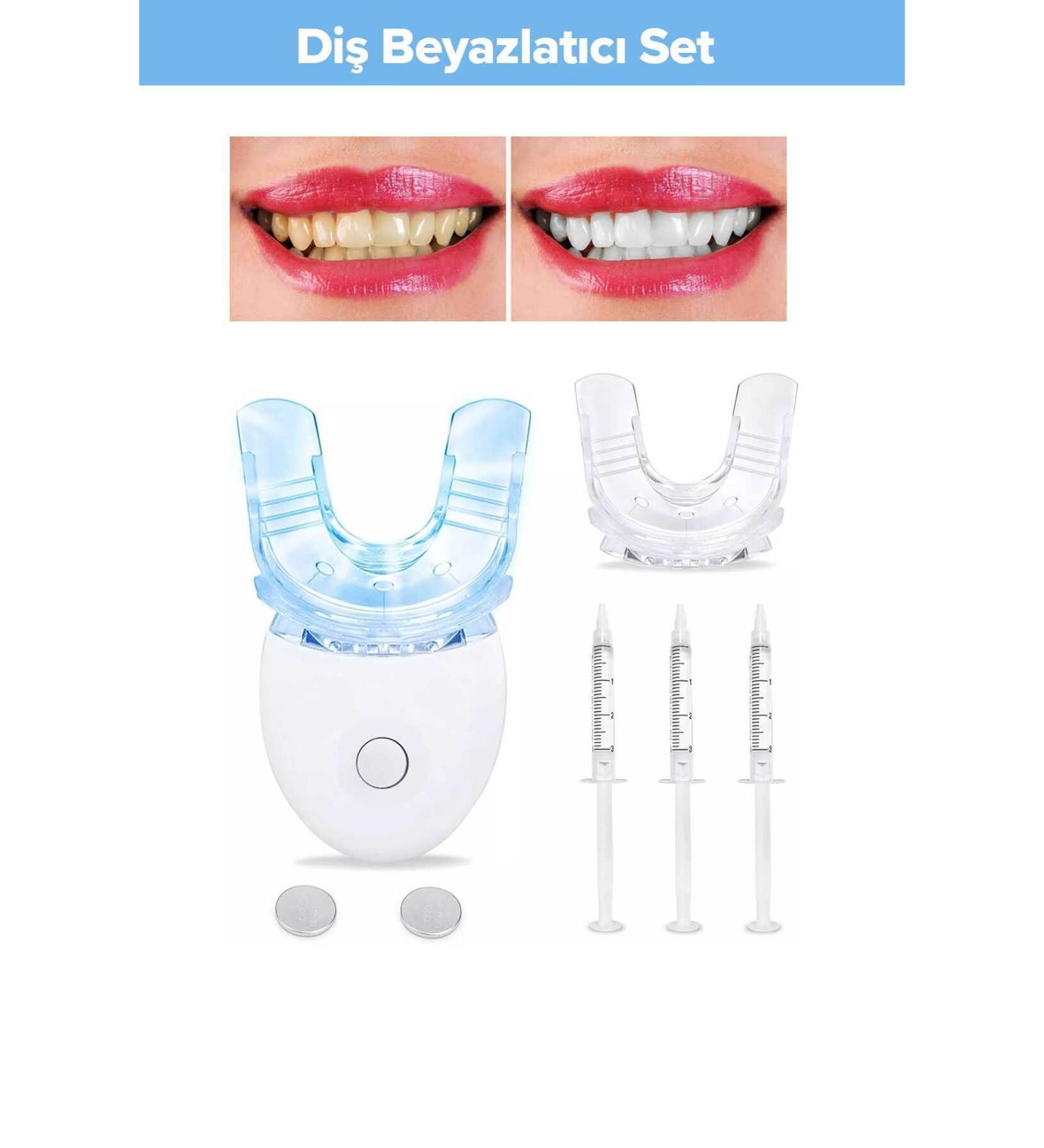 smileshop Teeth Whitening Kit - Buy Online on GoSupps.com