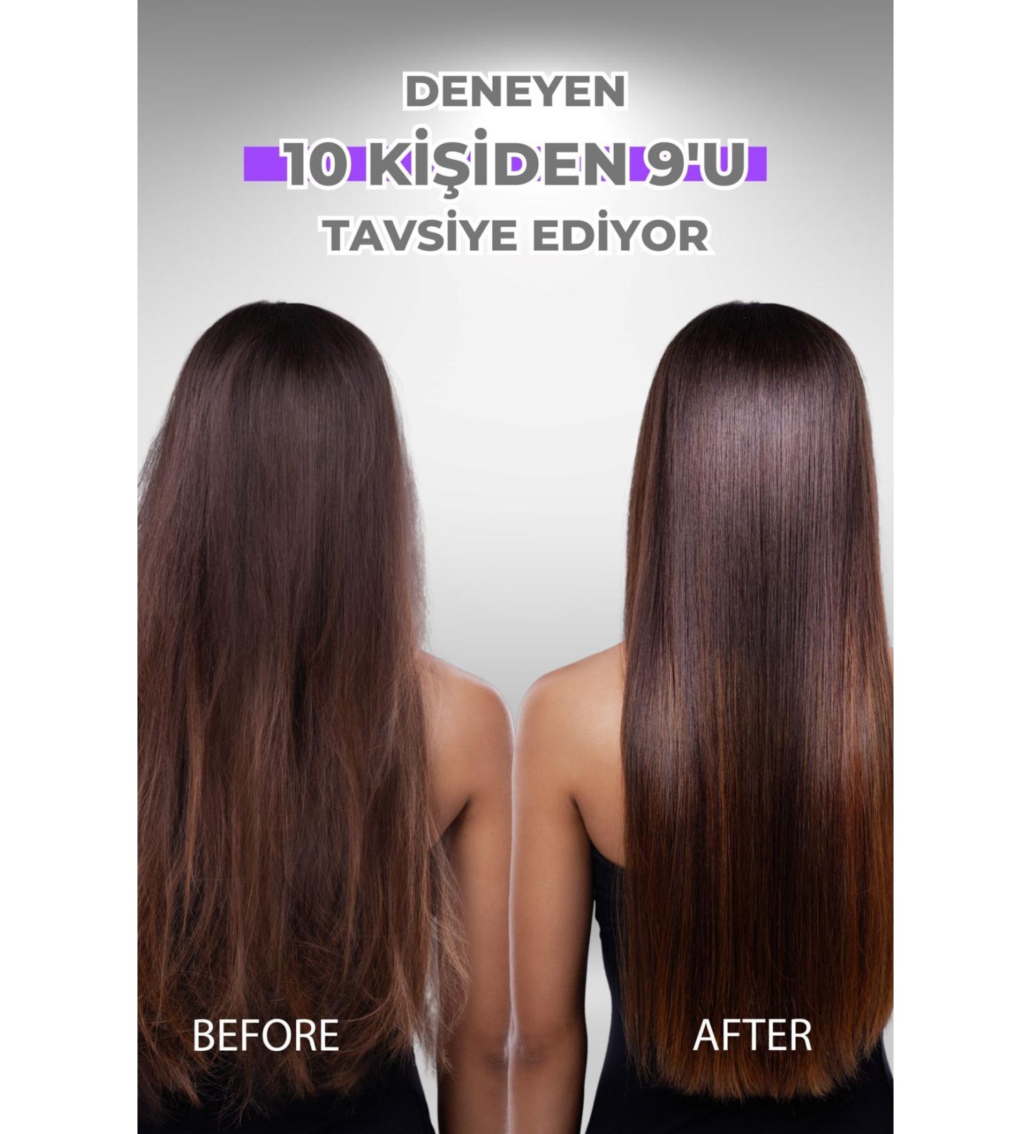 Topicrem Ultra Moisturizing Serum 30 Ml