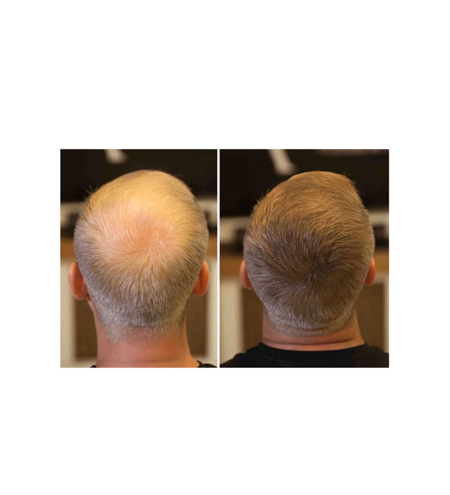 FIXPLANT Hair Volumizer 3 Bottles Topik 84 Gr. | Hair Powder for Thin Hair | Hair Fiber - Buy Online on GoSupps.com