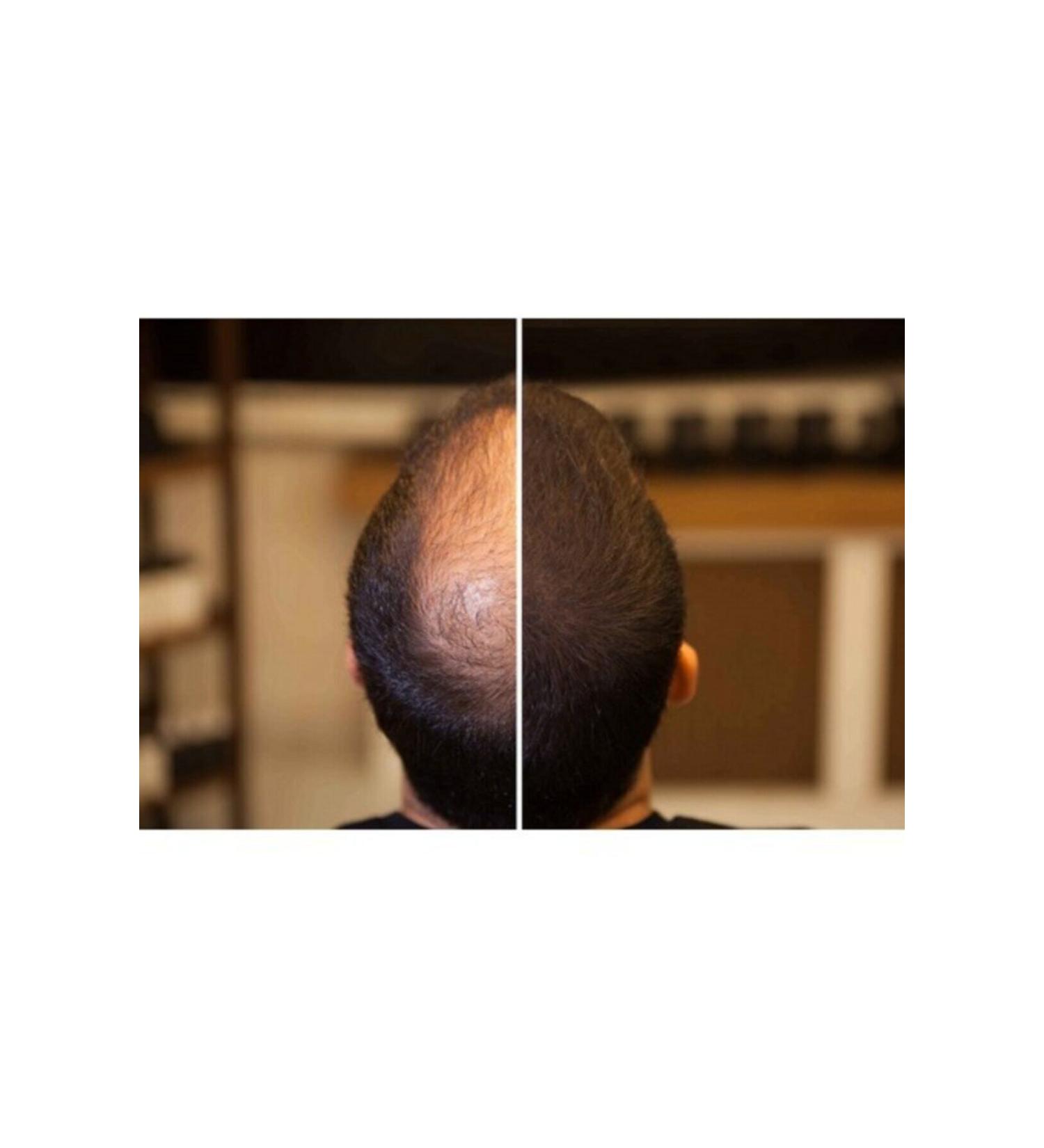 FIXPLANT 4 X 28 gr Black Hair Powder