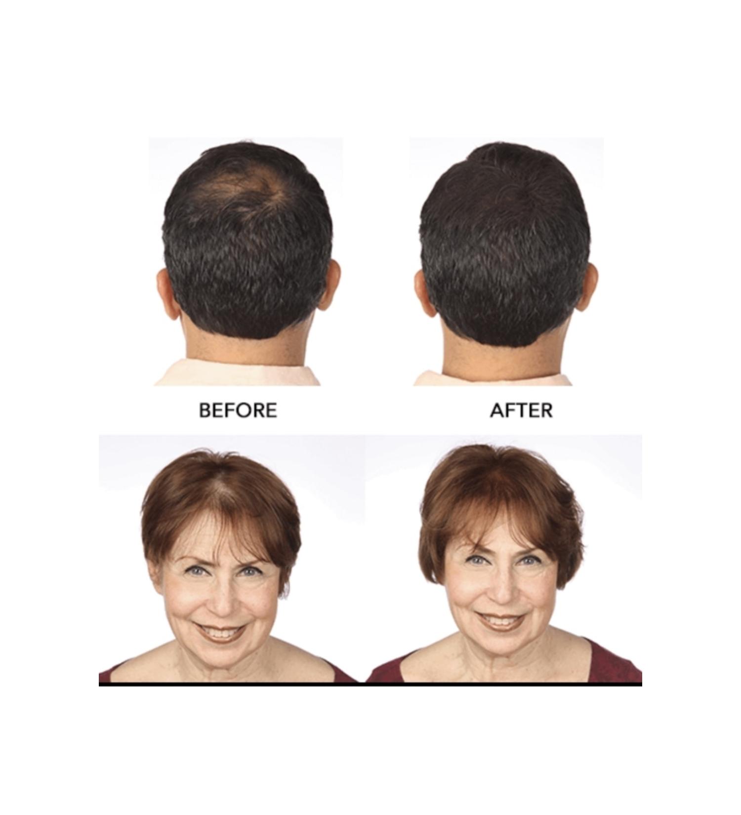 HairMax For Density Hairmax Hair Fibers Topik - Buy Online on GoSupps.com