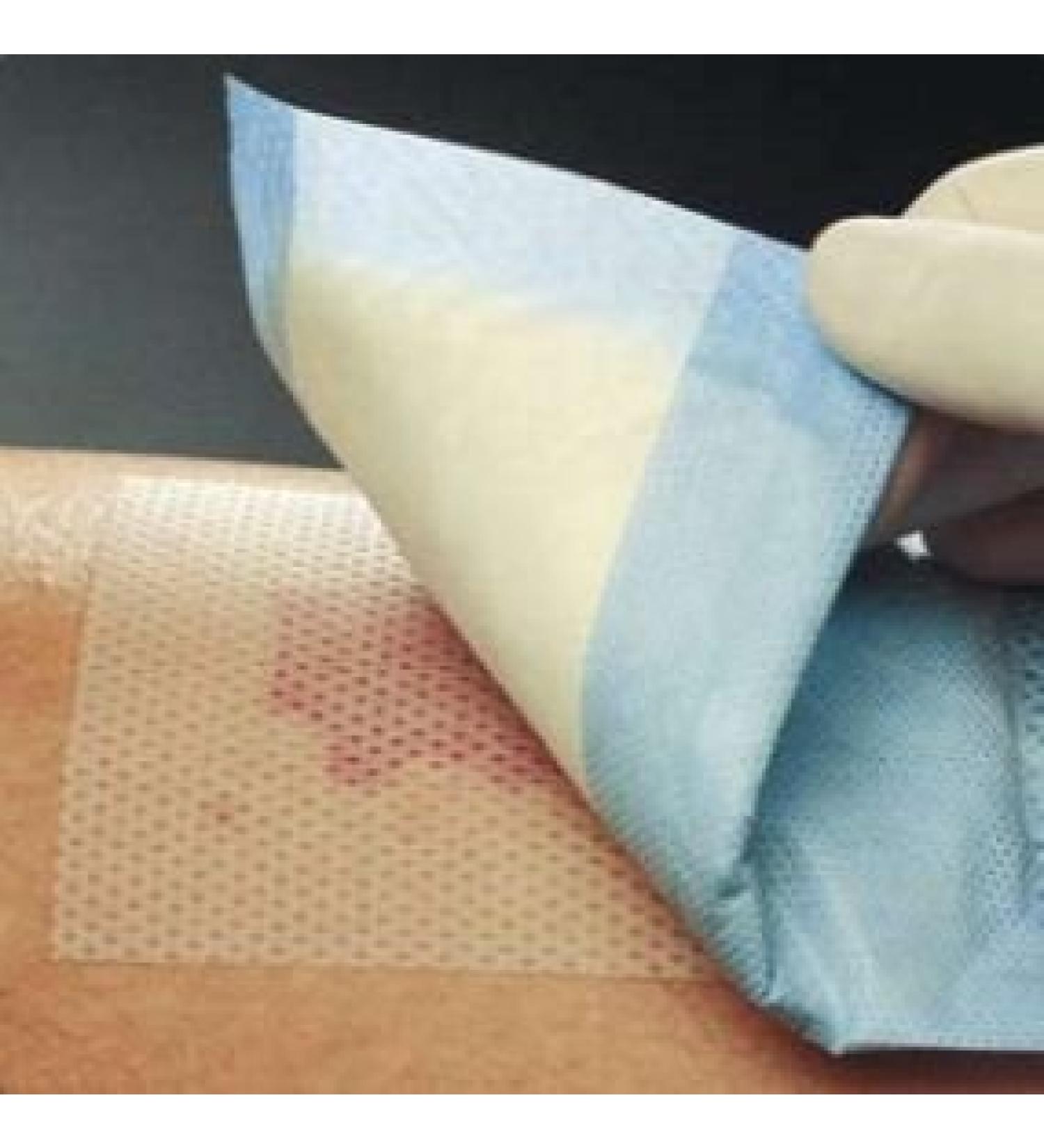 Mepitel 8" X 12" Non-Adherent Silicone Dressing 5/BX by Molnlycke Wound Care