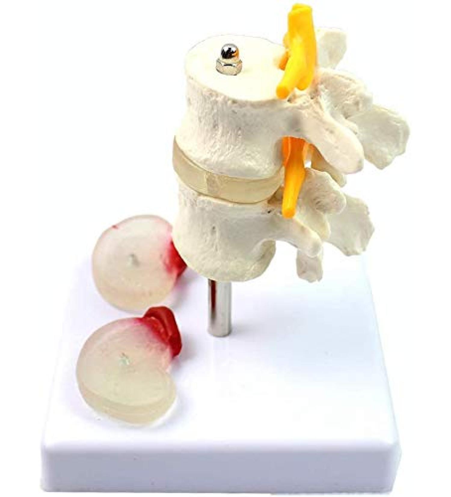 Model of Human Spine Detachable Medical Teaching Model Lumbar Spine Injuries with 2 Intervertebral Disc Model Model - Buy Online on GoSupps.com