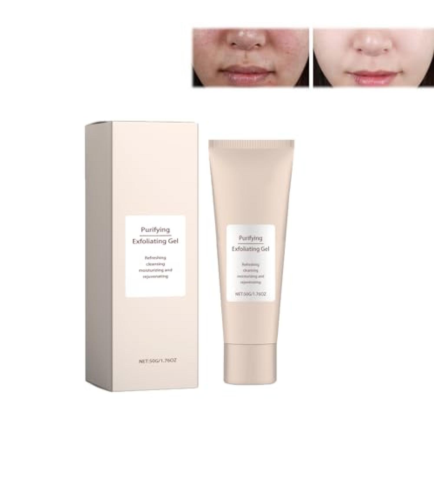 Bonseor Purifying Exfoliating Gel - Exfoliating Gel Cream Gel Face and Body Exfoliating Scrub Gel for All Skin (1 PCS) - Buy Online on GoSupps.com