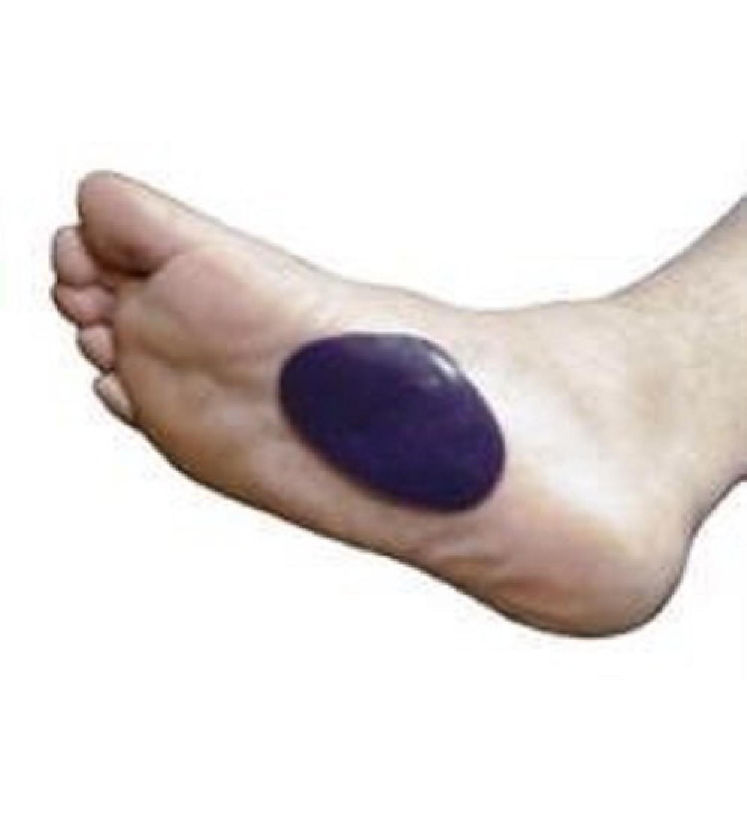 Dr. Jill's Foot Pads Gel Arch Pads Thick
