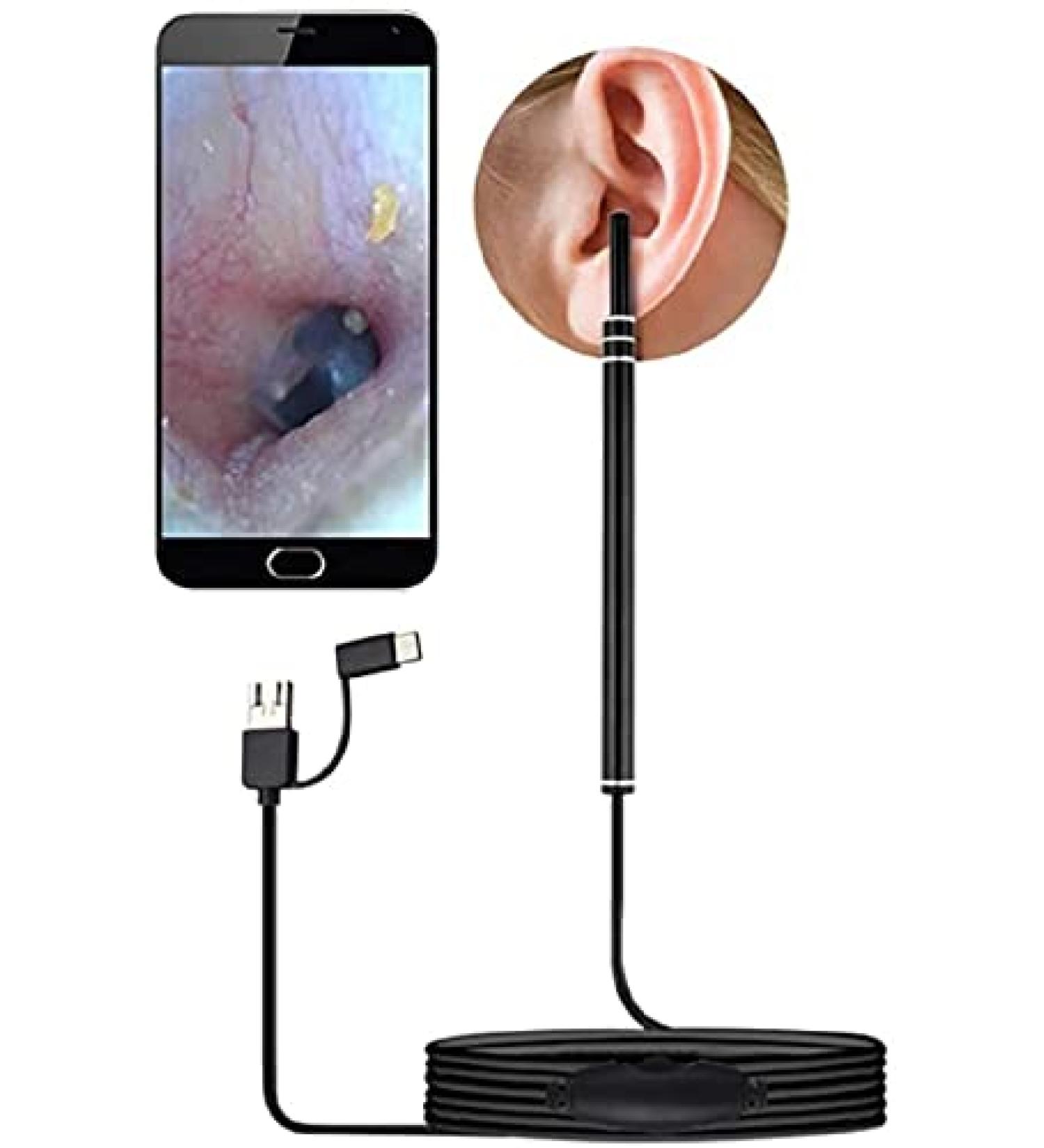 2021 Smart Ear Cleaning Kit with HD Otoscope Camera for Children and Adults - Ear Wax Removal Endoscope and Tools - Buy Online on GoSupps.com