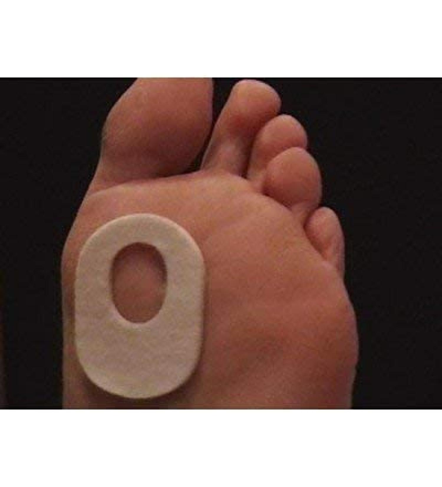 Pedi-Pads 1/8 Felt 104 Part 2159 by Aetna Felt Corporation - 100 Pack - Buy Online on GoSupps.com