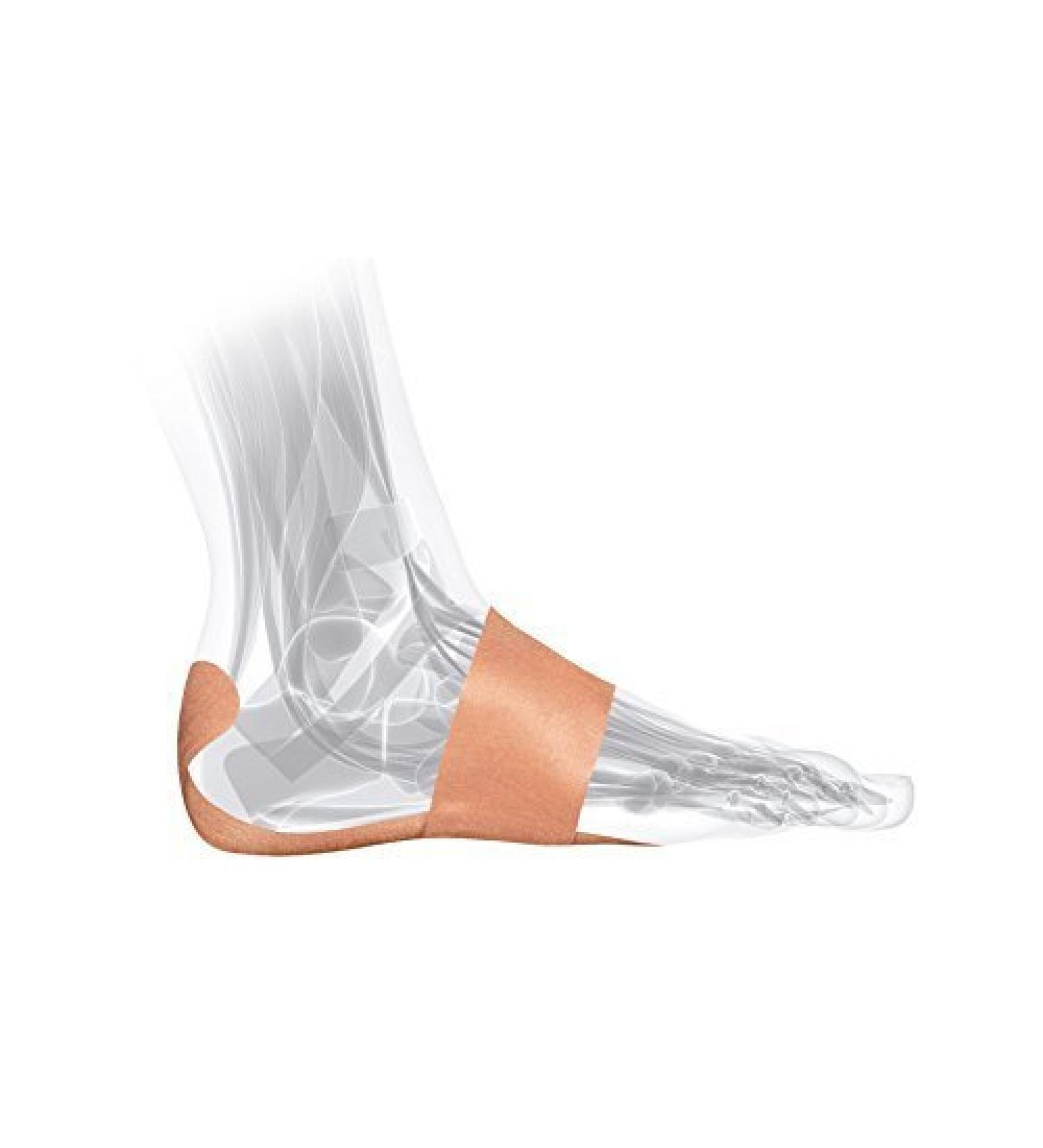 Heel Pain Relief System for Plantar Fasciitis - (7 applications)