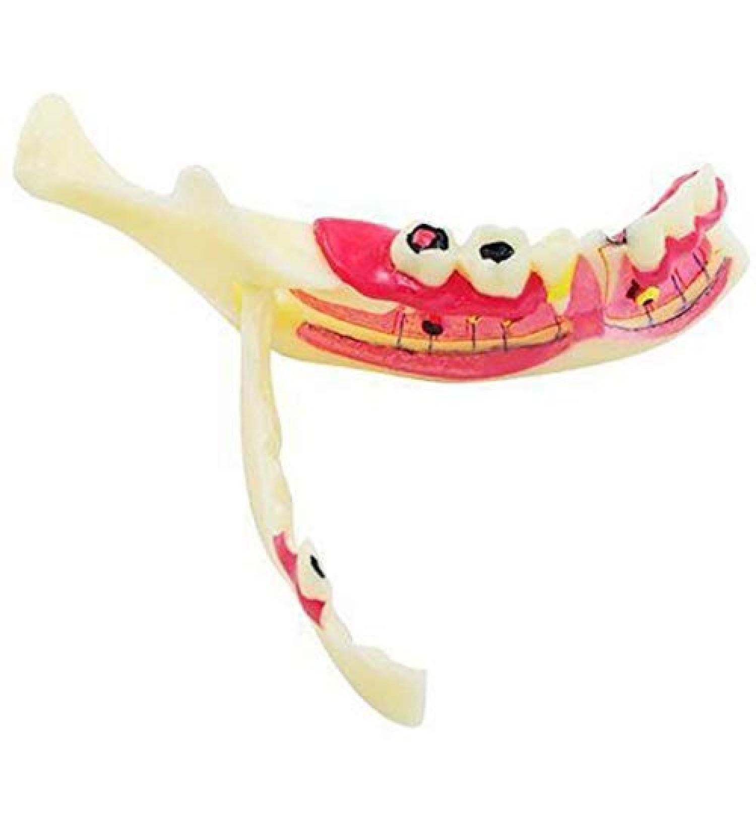 DYTAH Pathological Teeth Model - Right Oral Mandibular Communication for Medical Science - Buy Online on GoSupps.com