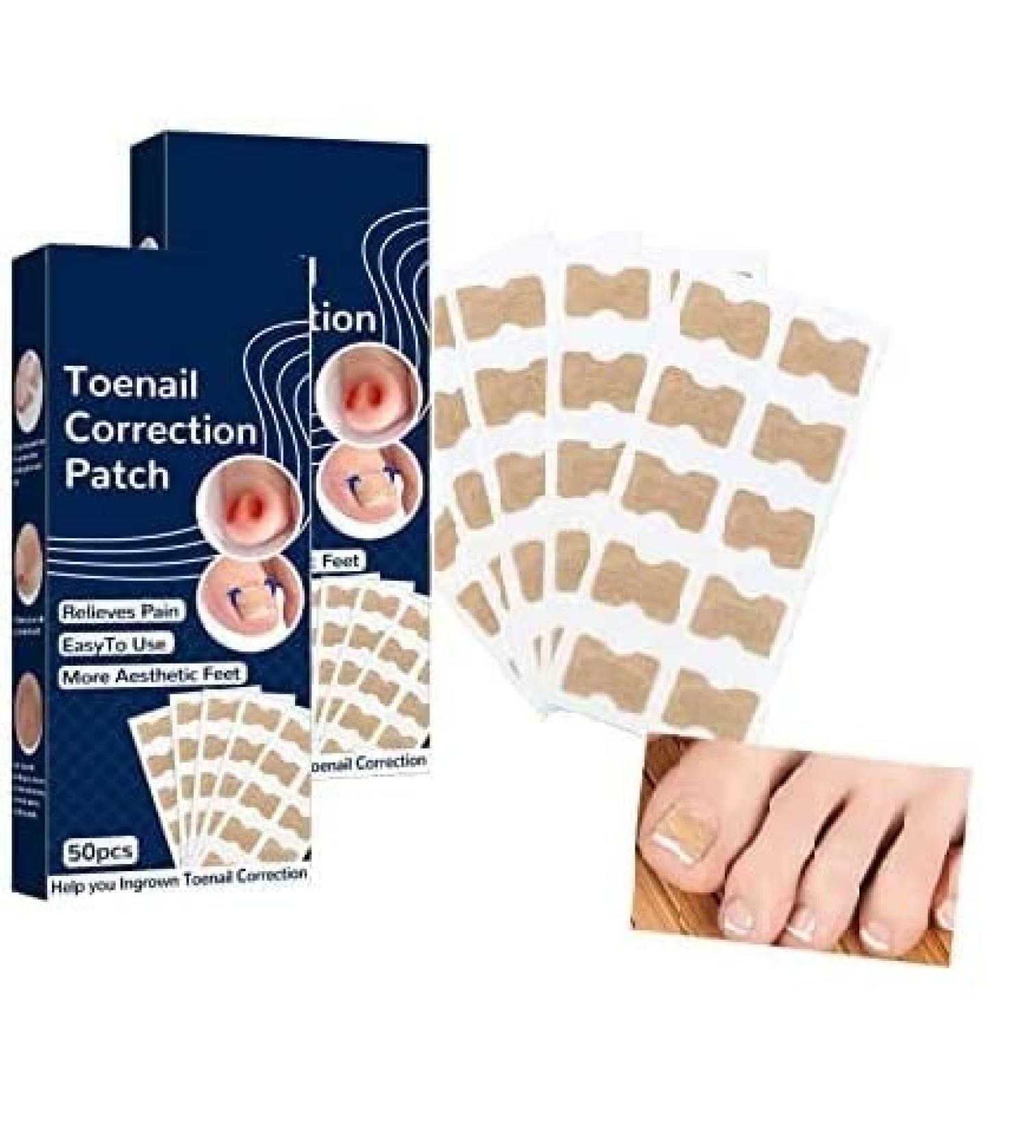 Toenail Correction Patch 100PCS - Professional Ingrown Toenail Corrector Strips for Foot Care - Health Toenail Treatment Tool for Glue-Free Nail Correction - Blue - Buy Online on GoSupps.com