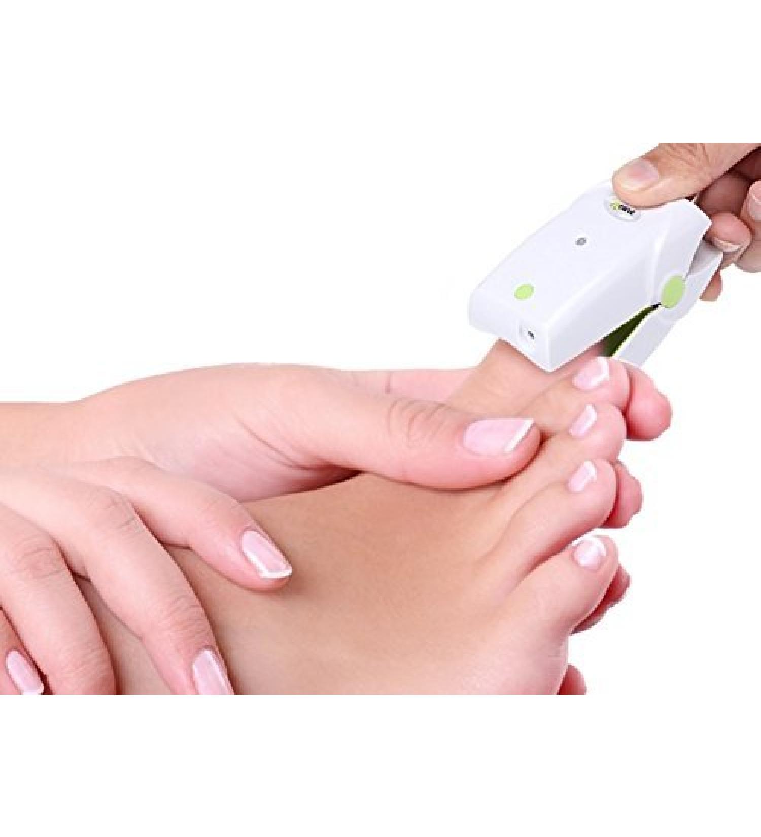 Nail Cleaning Laser Device - Safe & Quick Fungus Treatment for Toes & Fingers | Painless No Side Effects - Buy Online on GoSupps.com