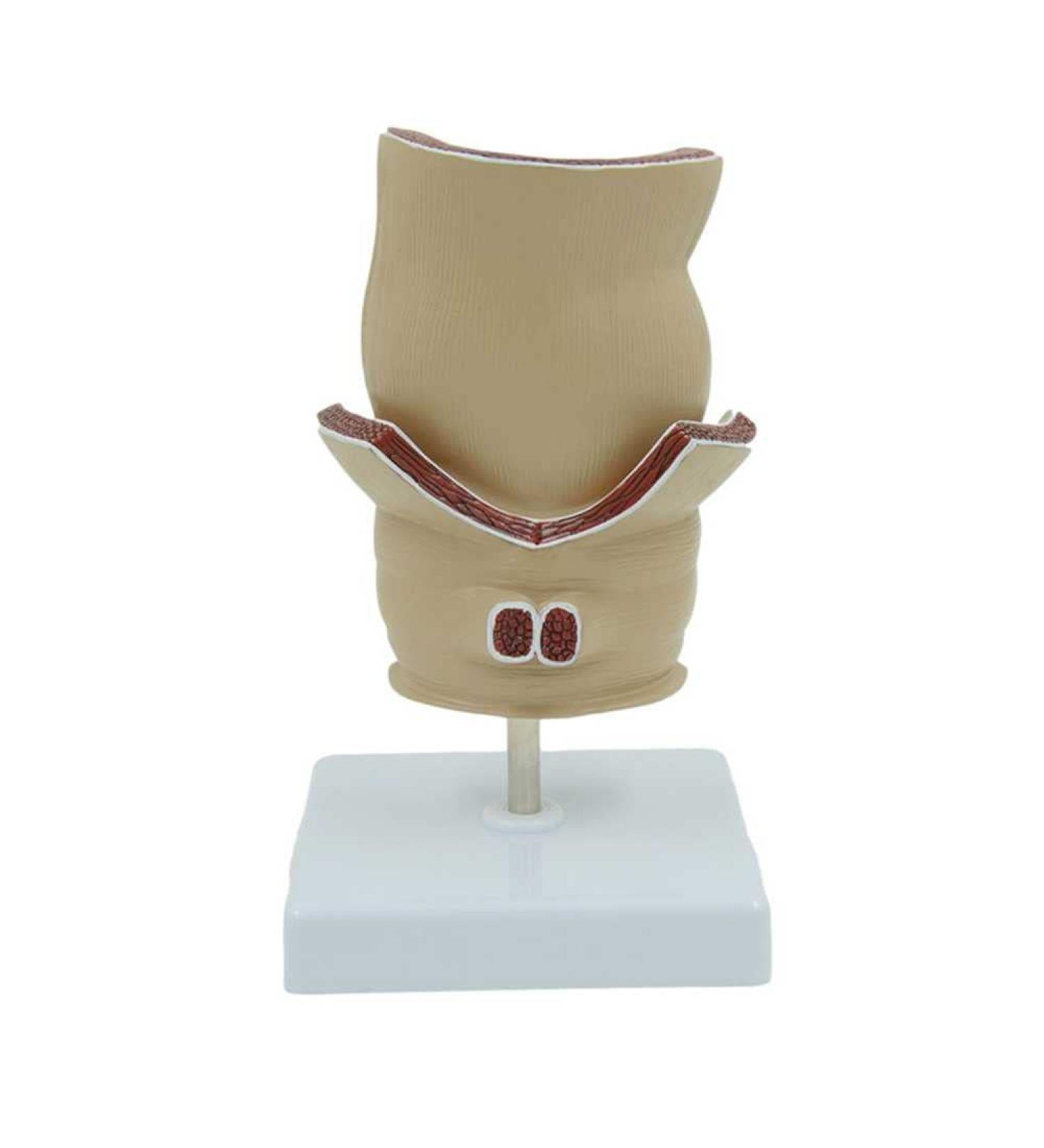 Humanly Rectal Hemorrhoid Lesions Anatomical Model Dilkpunkt Anal Anorectal - Buy Online on GoSupps.com