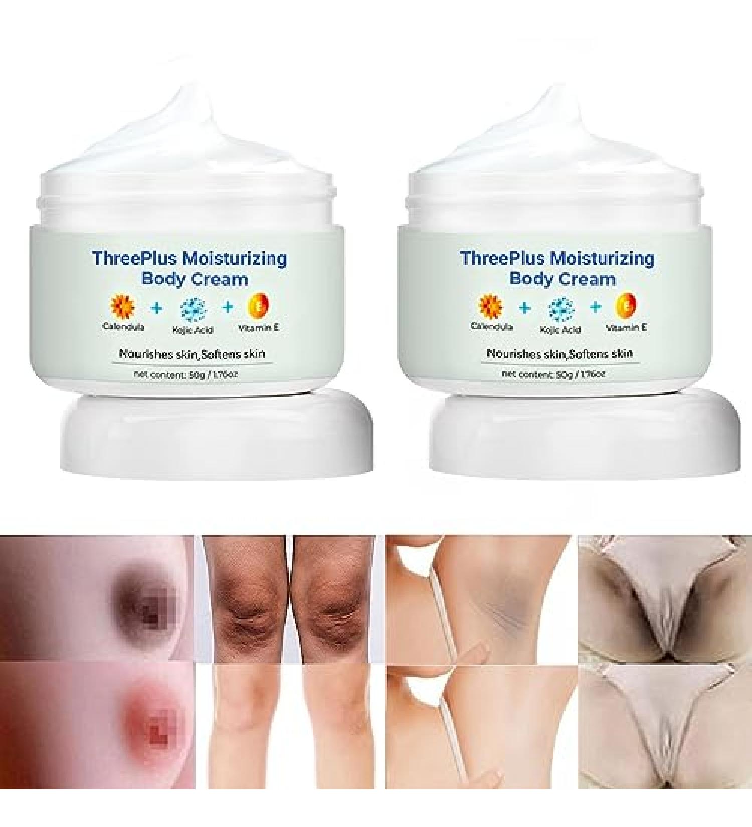 Cremas Para Las Manchas de La Corporales Para Piel Entrepierna Manchas Codos Piernas Zonas ntimas Cara Axilas Rodillas Cuello 50G (2pcs) 1 Fl Oz (Pack of 1) - Buy Online on GoSupps.com