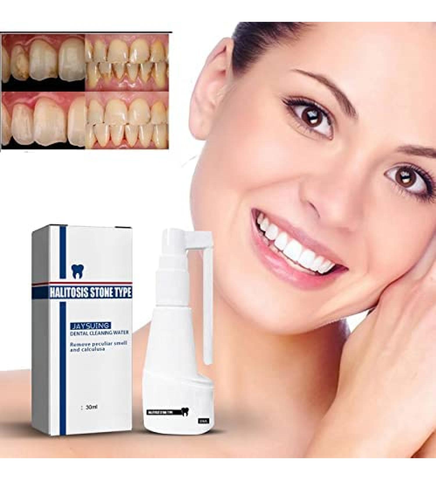 Calculusfree Dissolving Dental Spray - Mouth Refreshing Teeth Cleaner & Stain Remover - 1 G (1 Pack) for Ultimate Oral Care - Buy Online on GoSupps.com