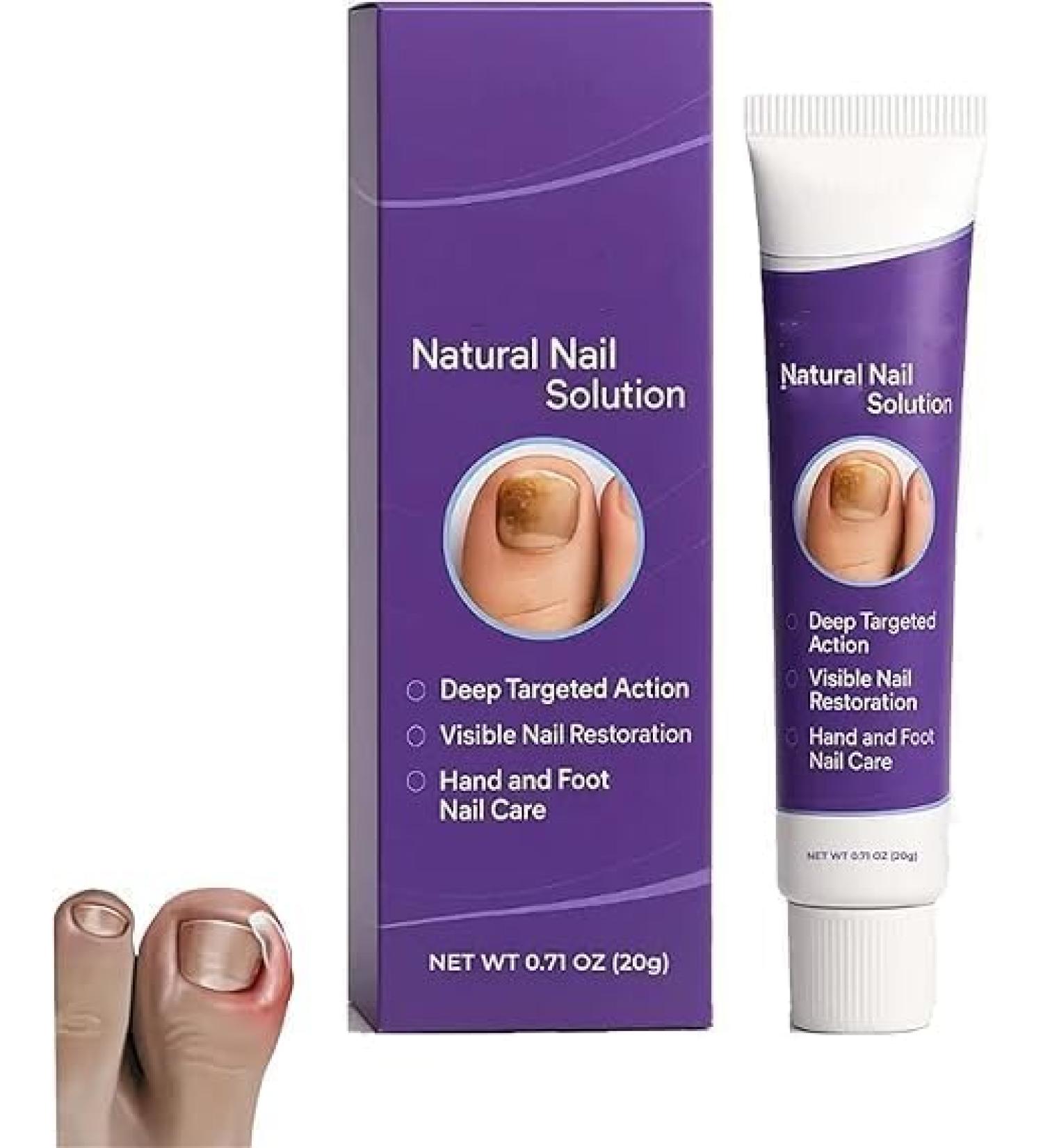 Cr me r paratrice pour ongles 2026 Solution naturelle contre les mycoses Spray r parateur avanc pour des ongles plus sains 1pcs - Buy Online on GoSupps.com