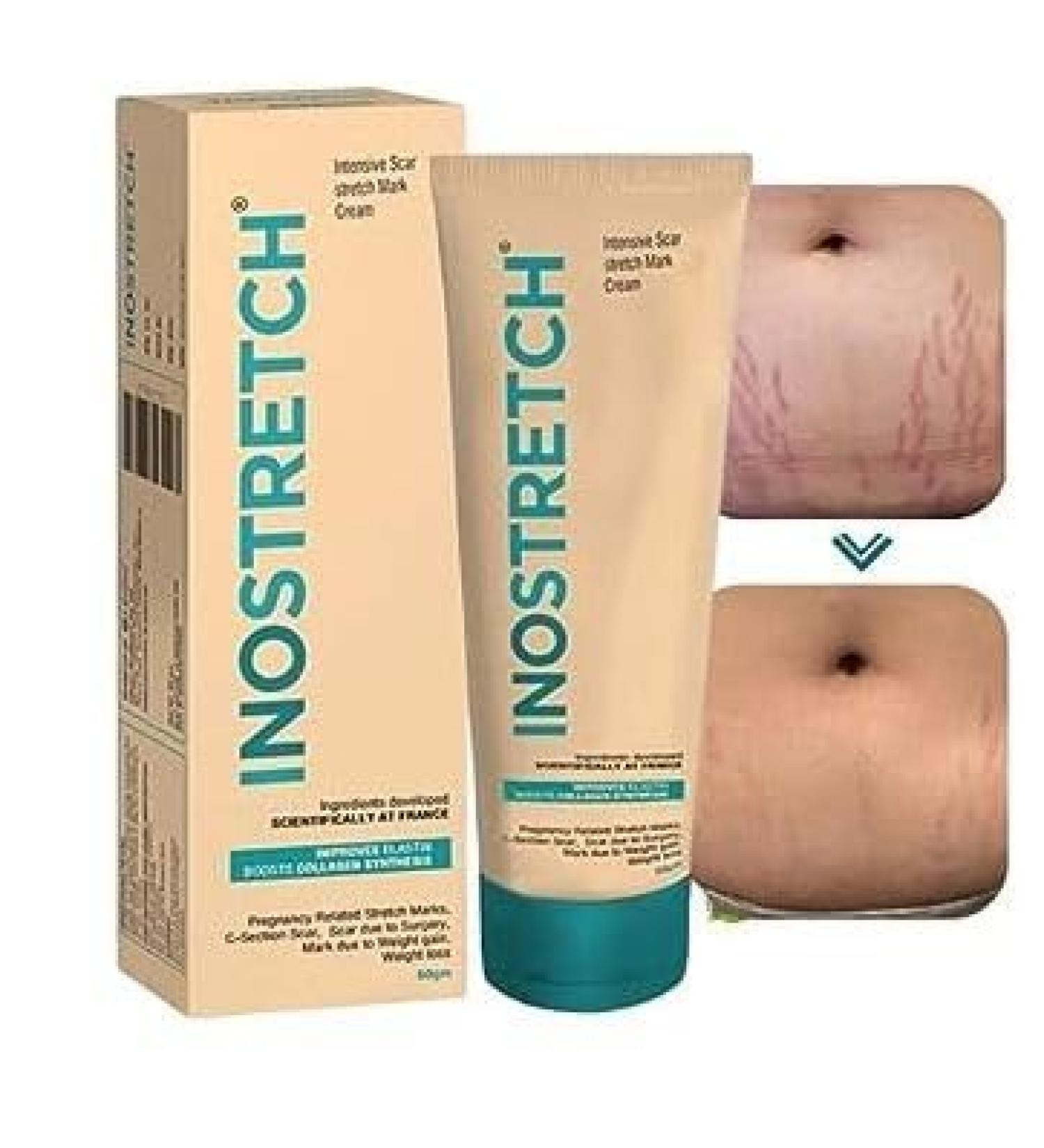 Buy I.nos tretc h Stretch Mark Cream - Reduce Stretch Marks & Scars with Natural Ingredients | 60g - International Shipping Available - Buy Online on GoSupps.com