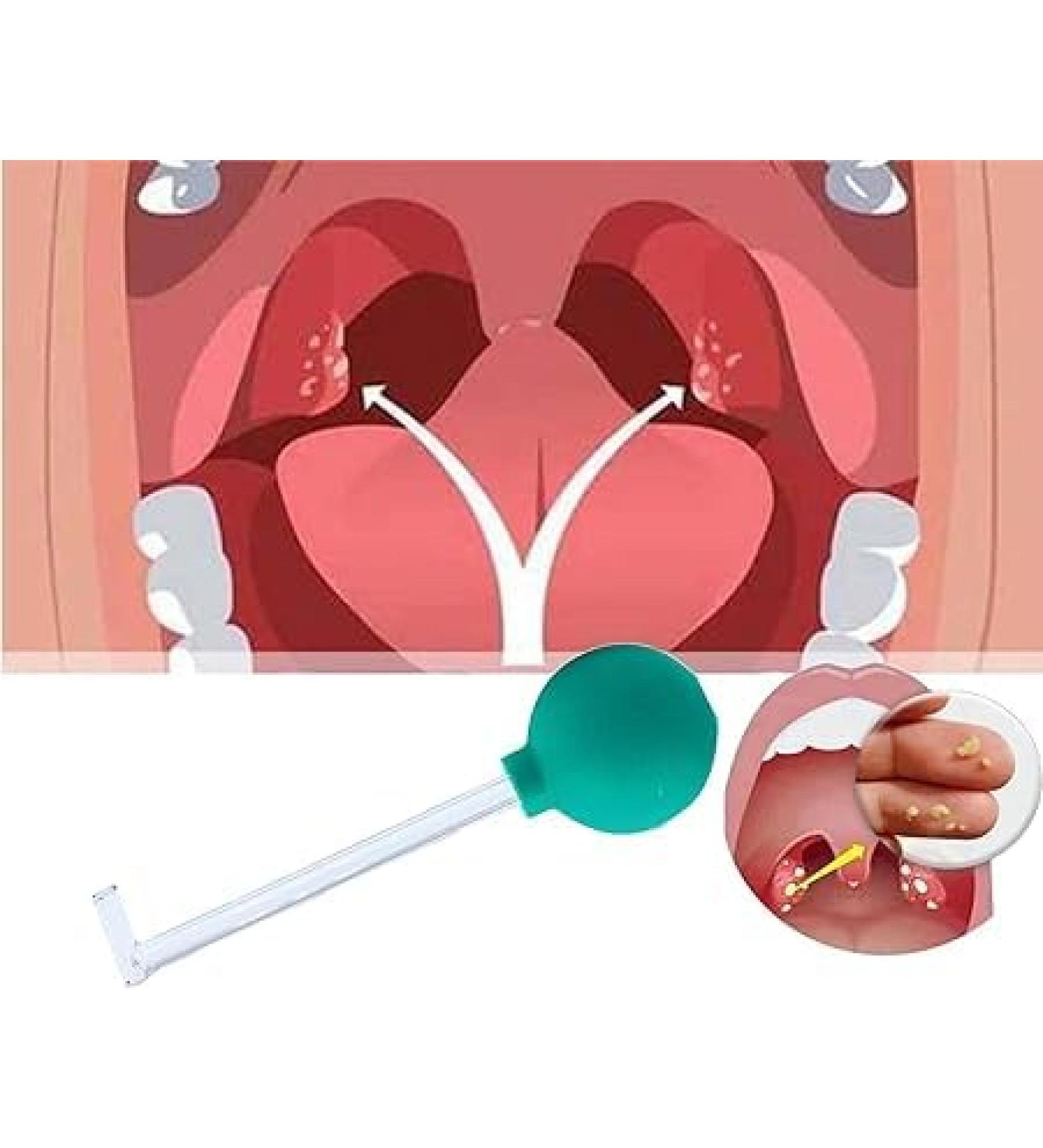 Remove almond stones tonsilenstein remover tonsilenstein removed for removing tonsil stones almond stones cupping glass effective mouth cleaning for a fresher breath (green)