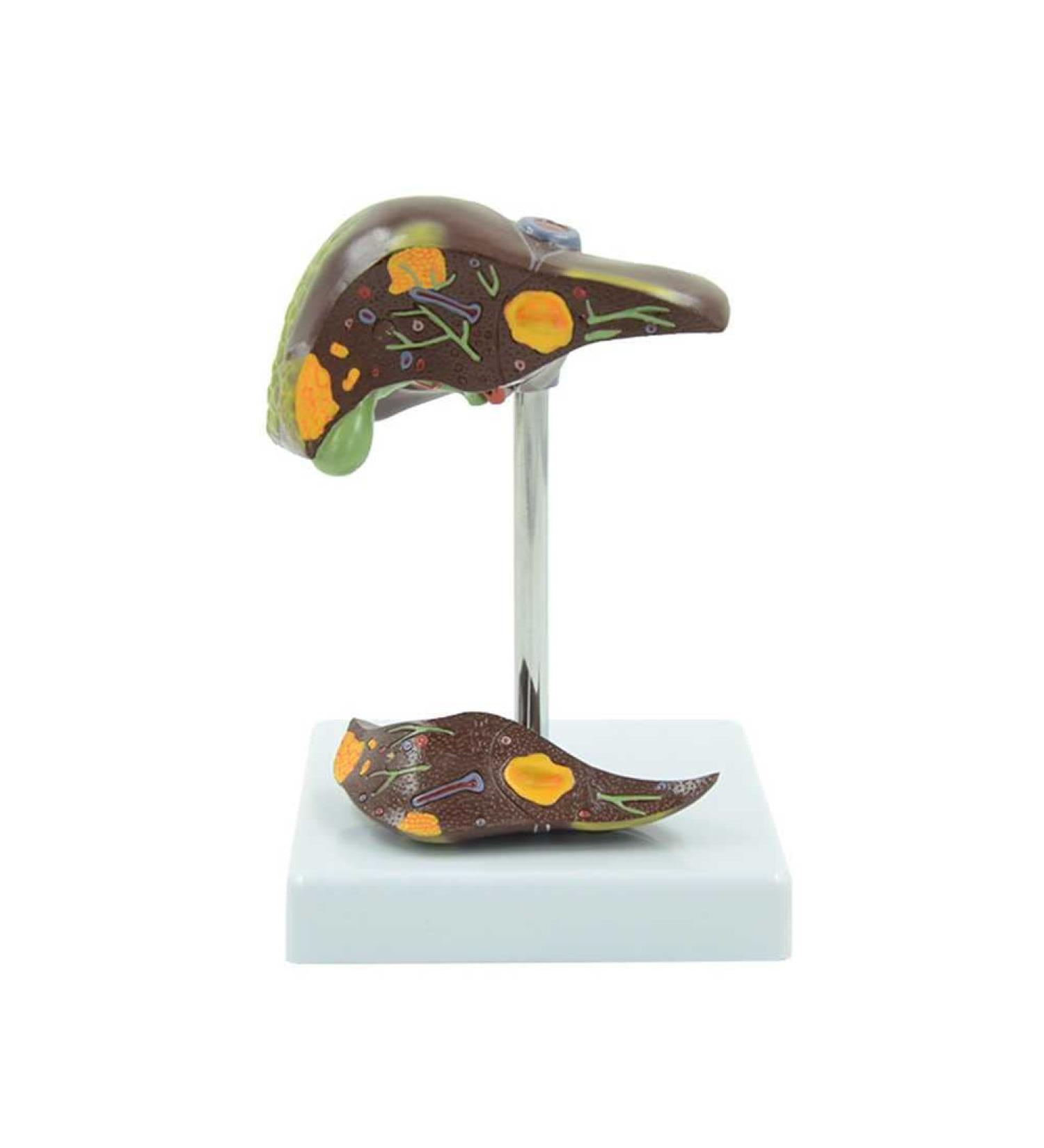 Pathological Liver Model Gallstone Model Fatty Liver Educational Training Aid - 11 * 11 * 15CM - Buy Online on GoSupps.com