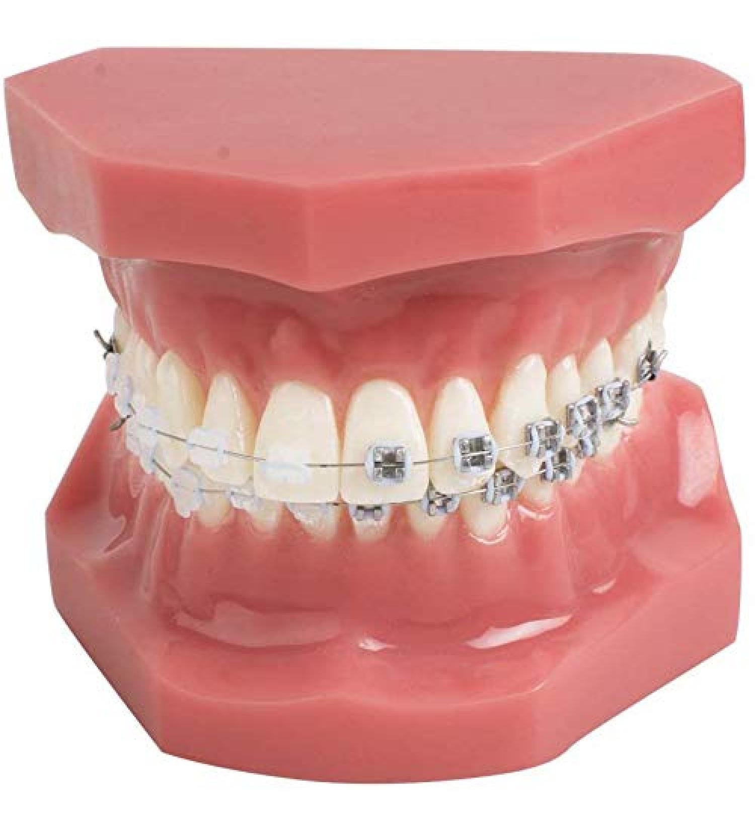 Orthodontic Teeth Model with Mental Brackets & Red Ligature - Tipodonto Dental Support for Treatment - Buy Online on GoSupps.com